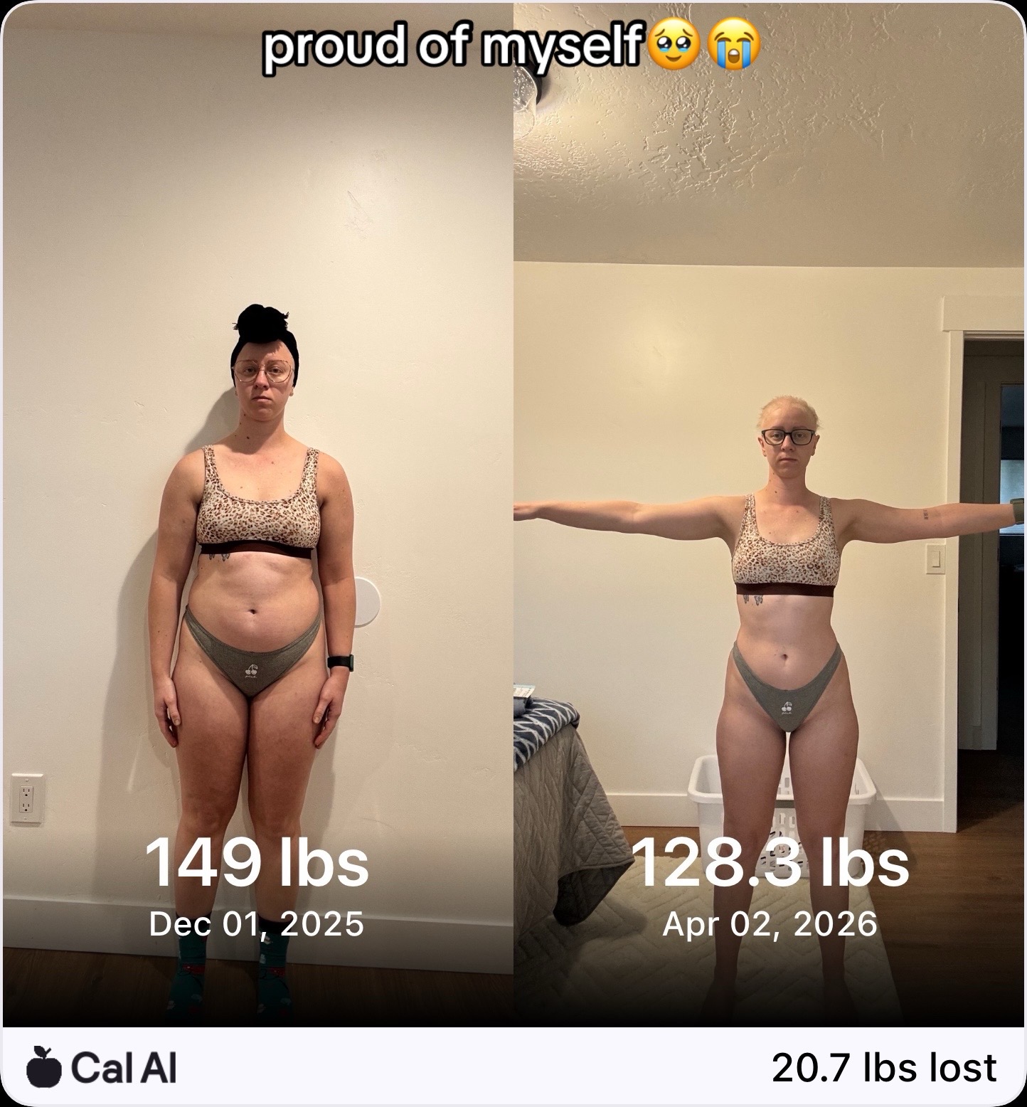 @KK&rsquo;s lupus journey!