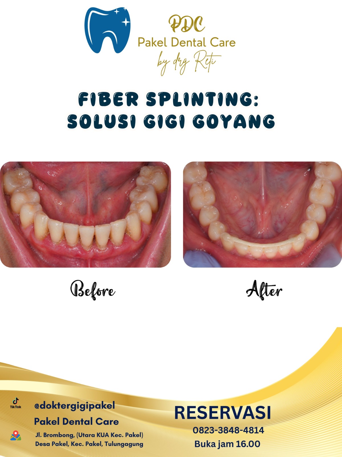 @Pakeldentalcare
