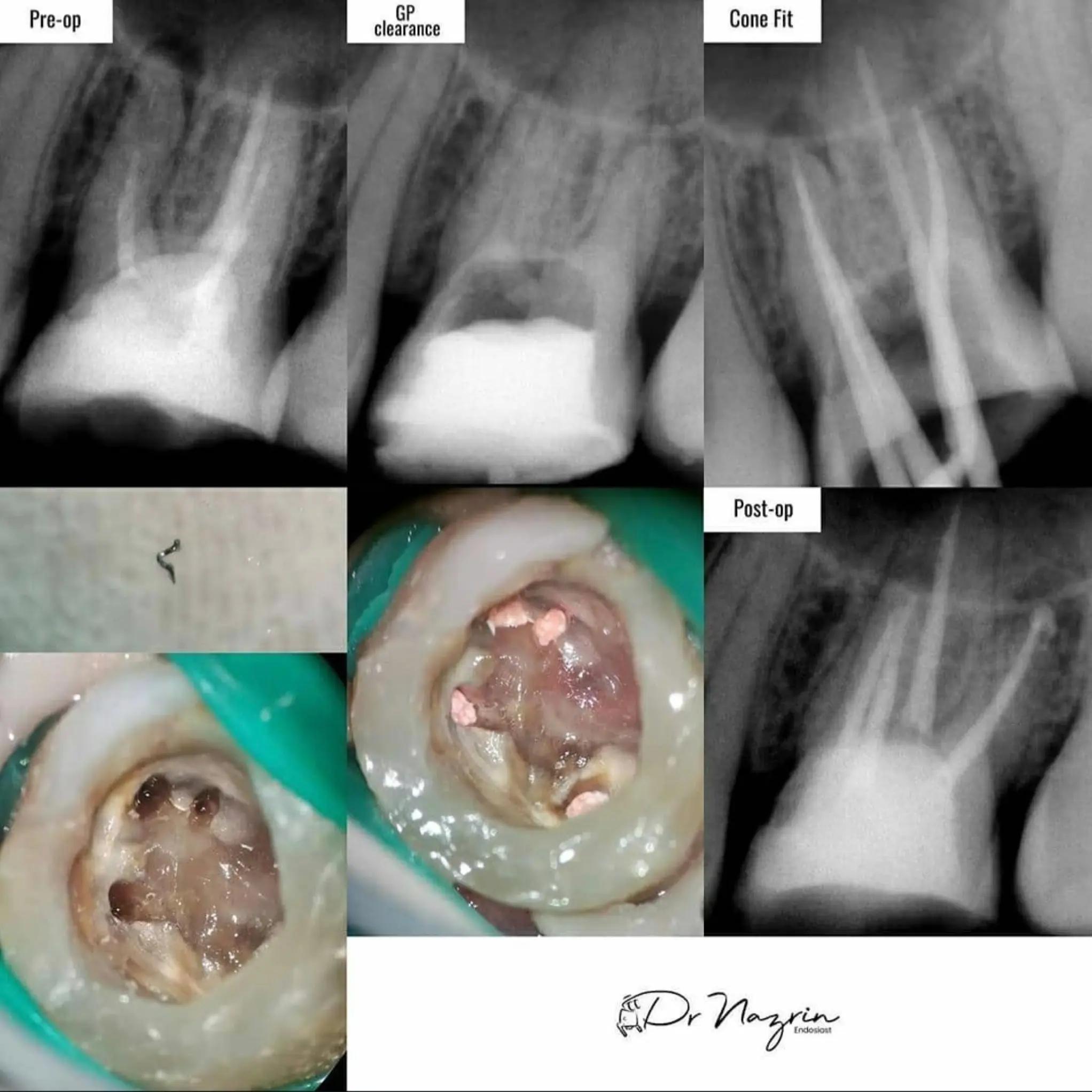 @Klinik Pergigian Erfa