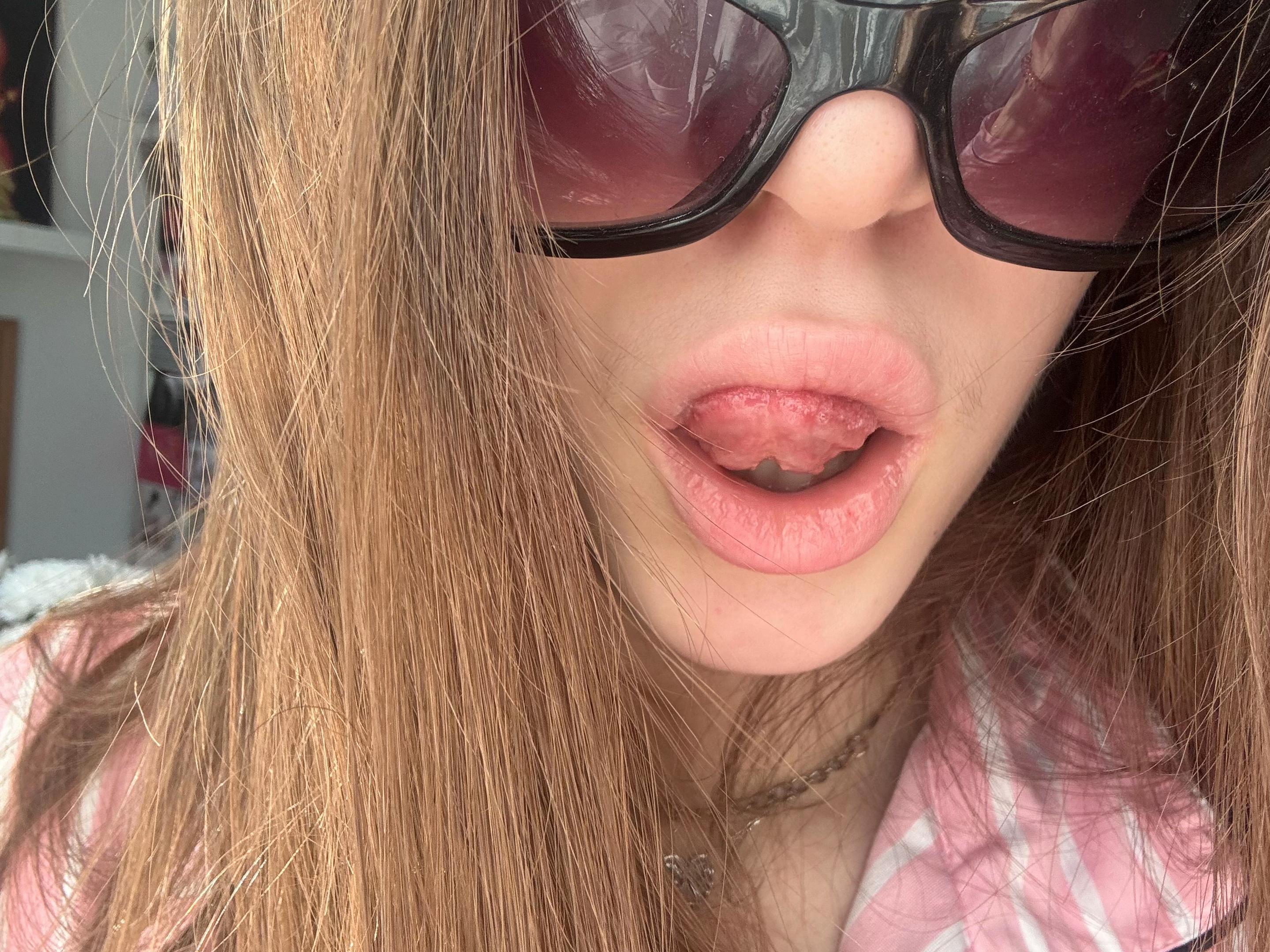 @иксэс