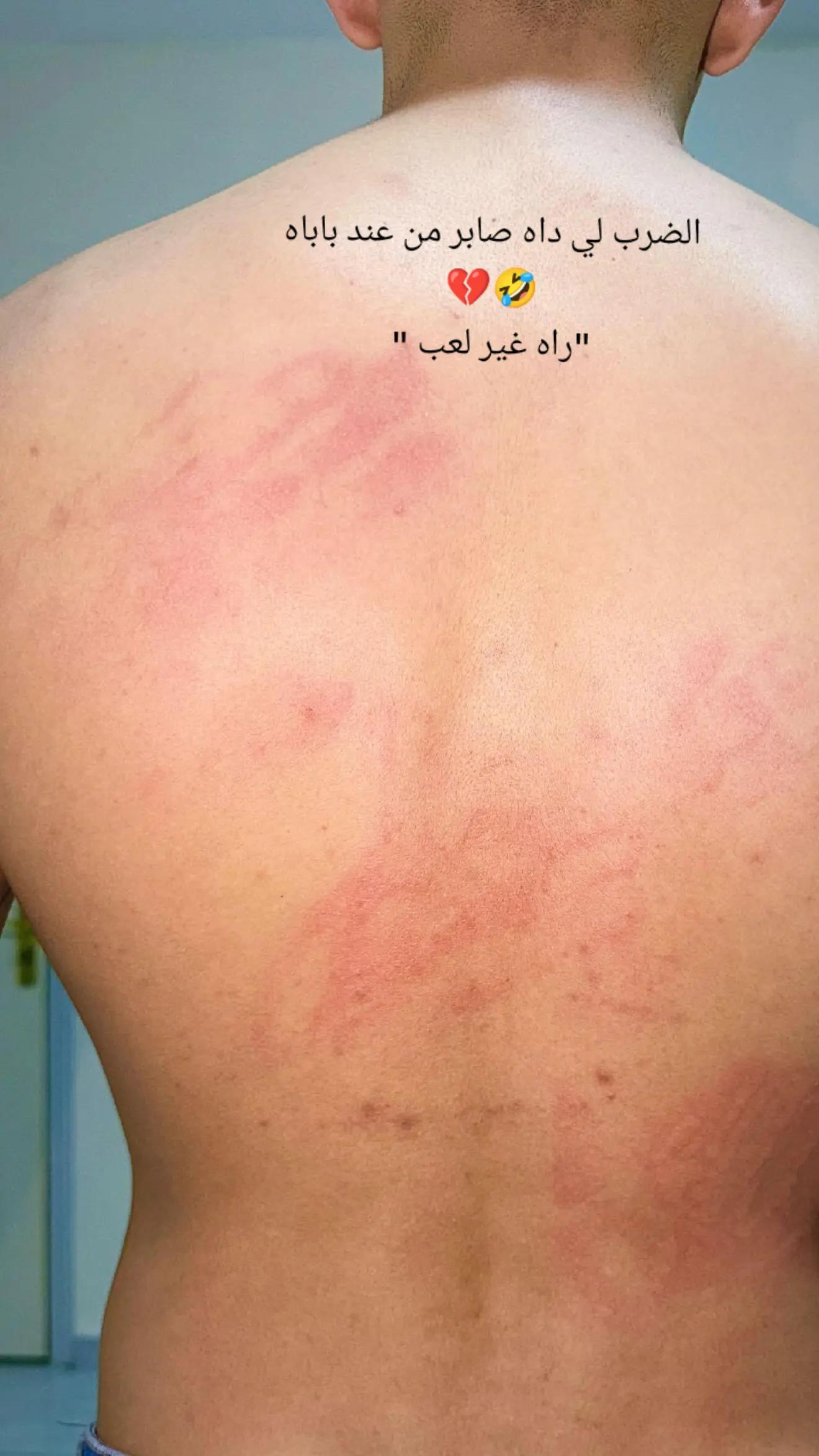 @Saber Koki fansโจ๐