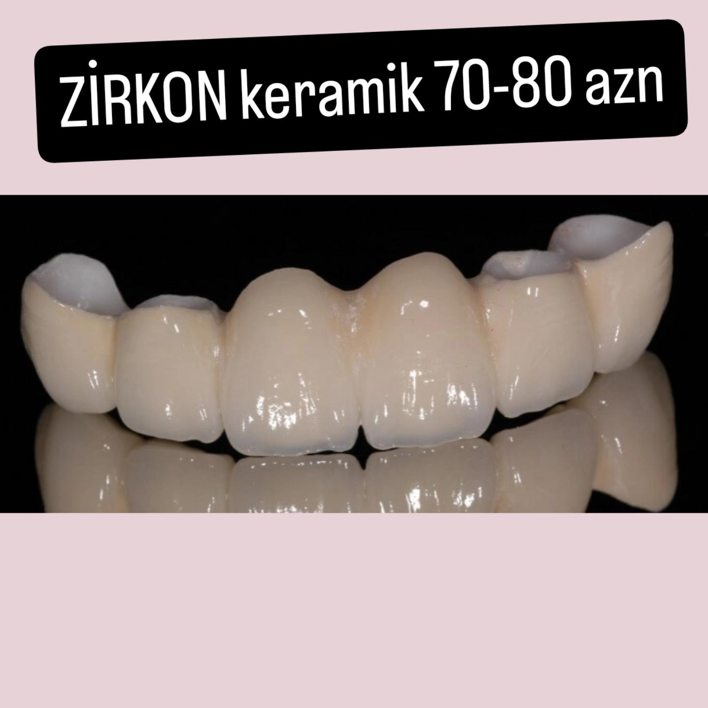 @implant.32