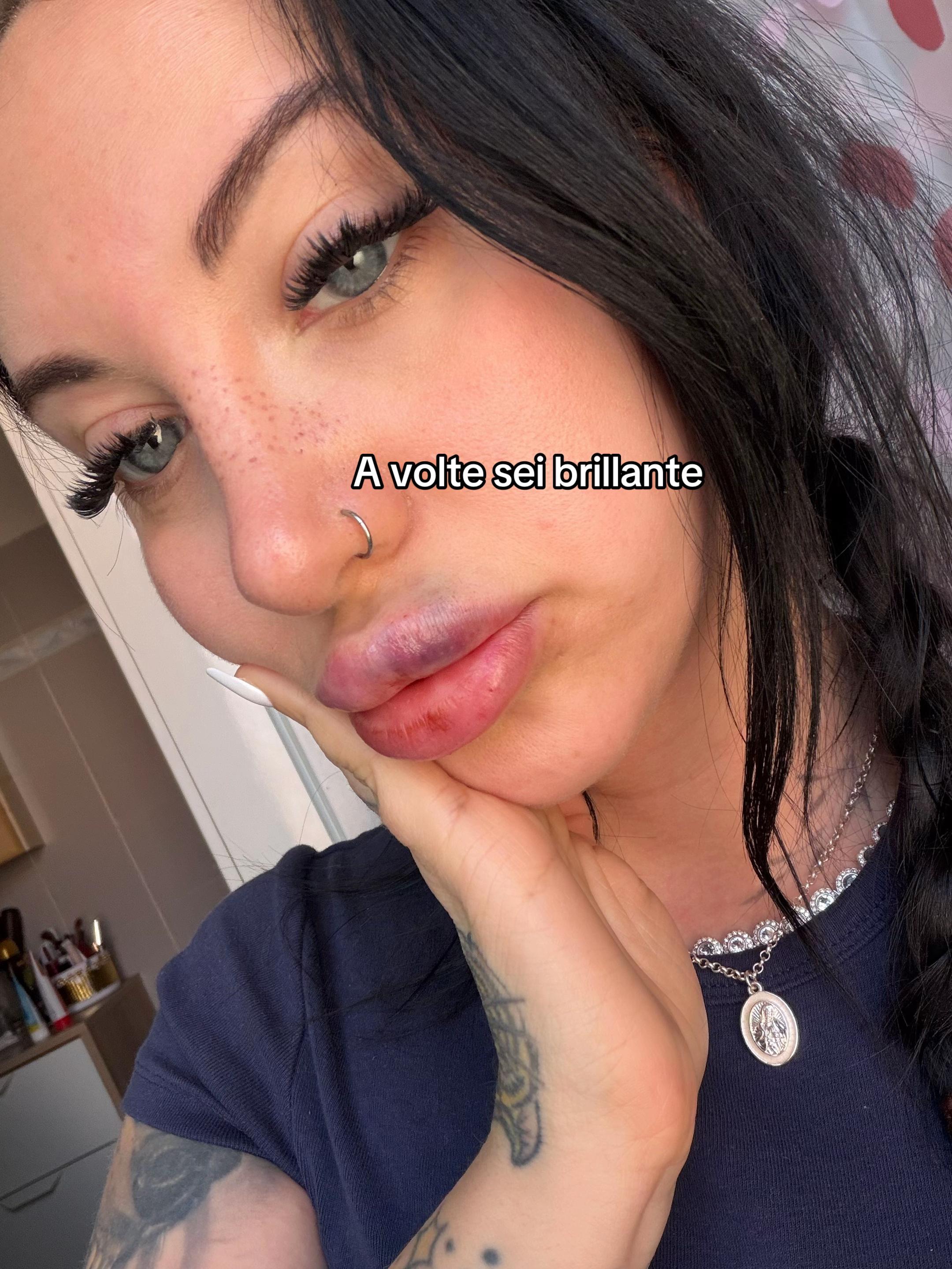 @Lynbelieveee
