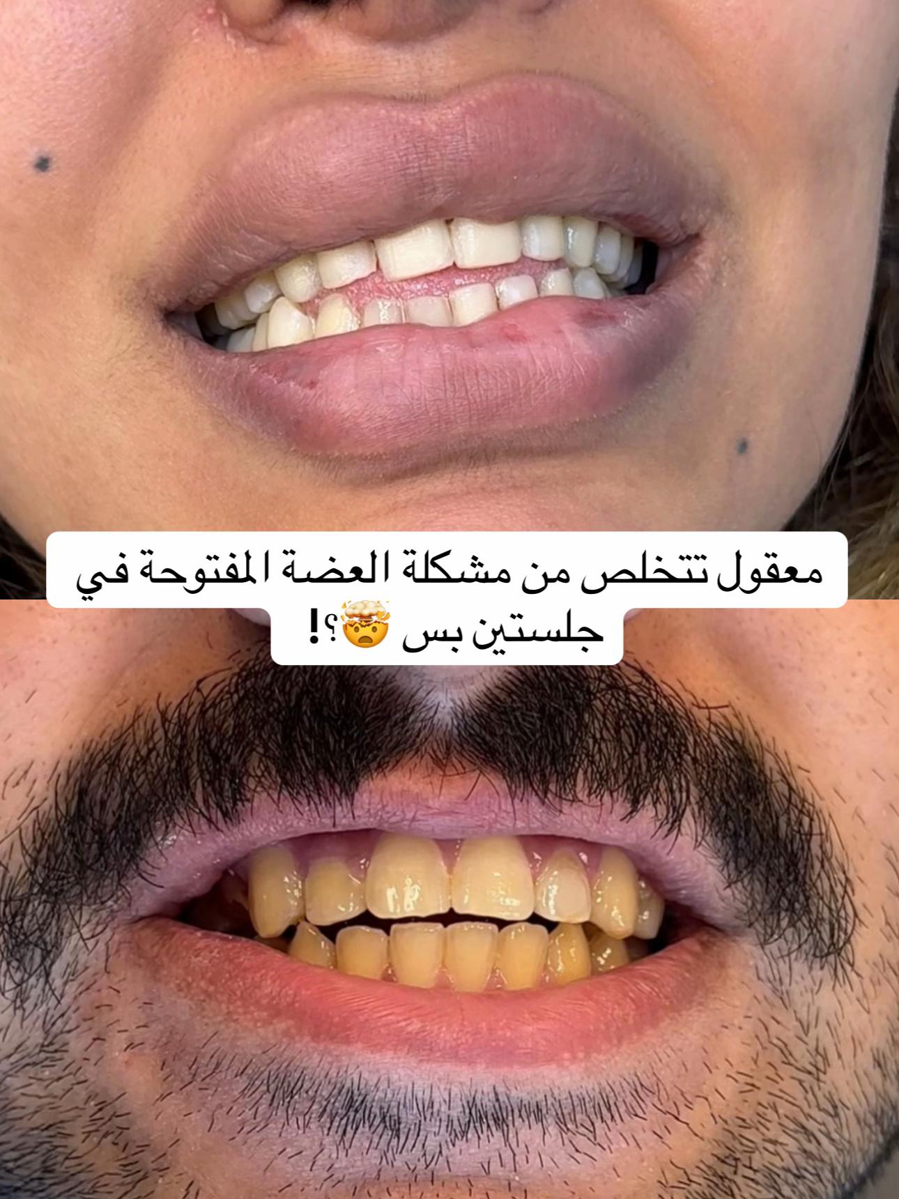 @Dr.lina_almasmoum