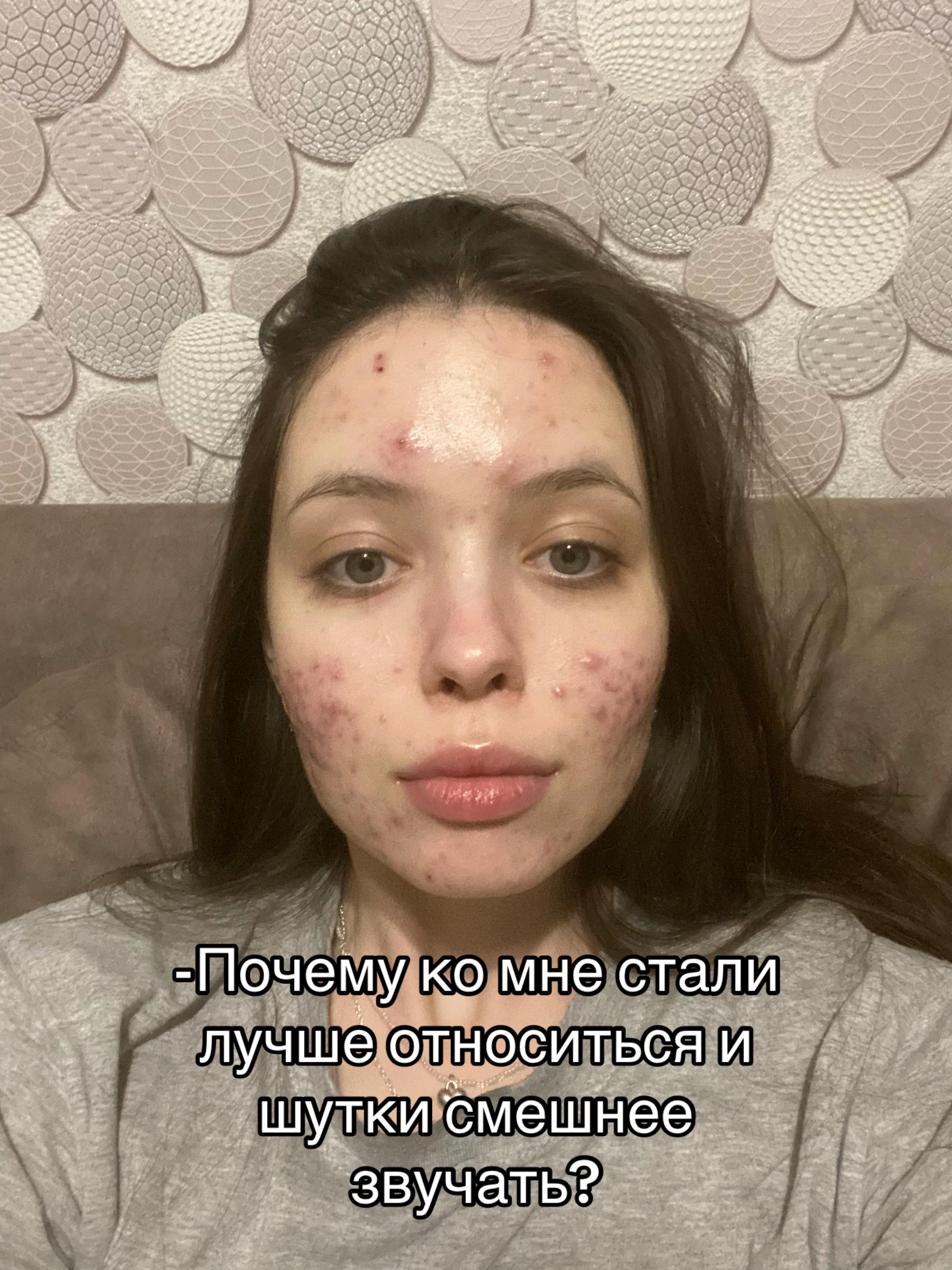 @elina