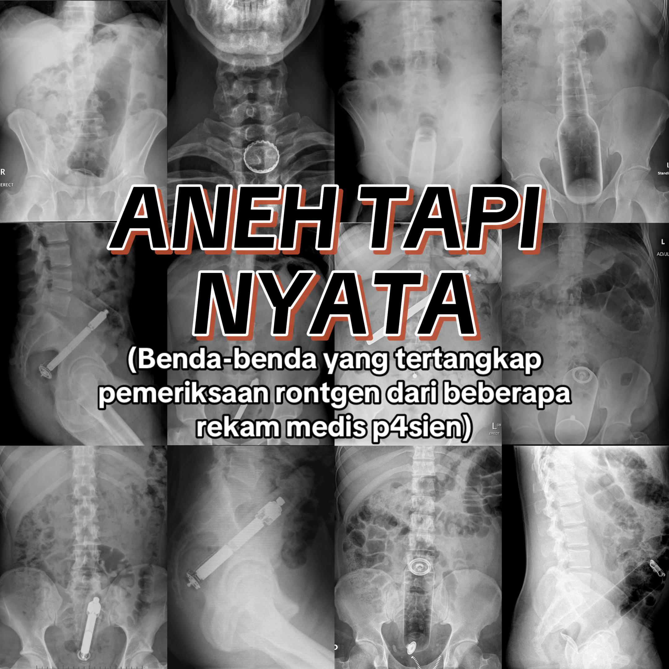 @Sobat Radiology
