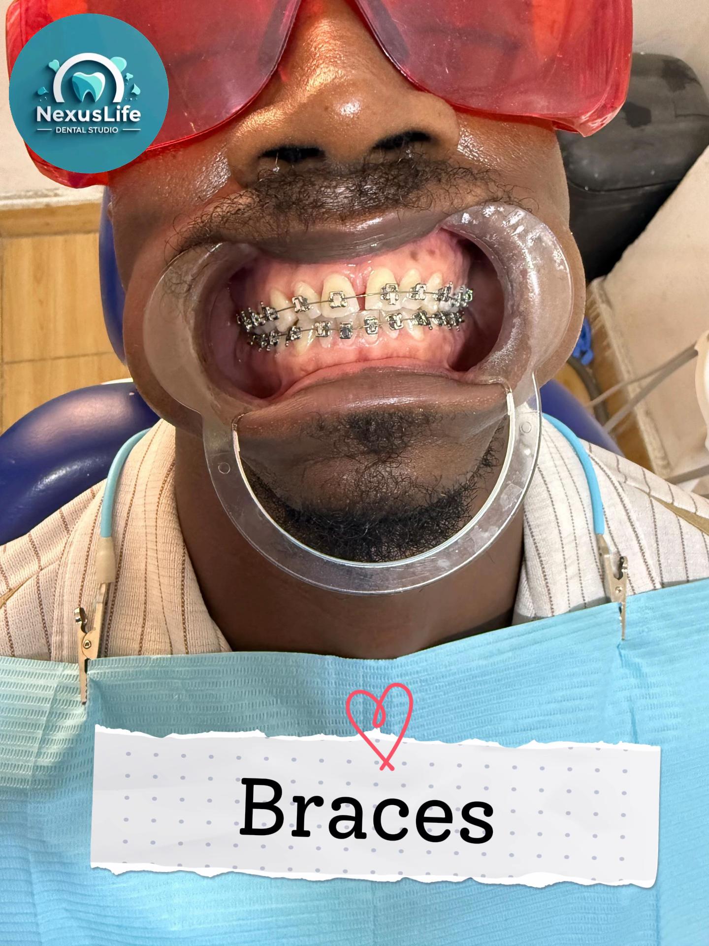 @NEXUSLIFE DENTAL CLINIC🦷