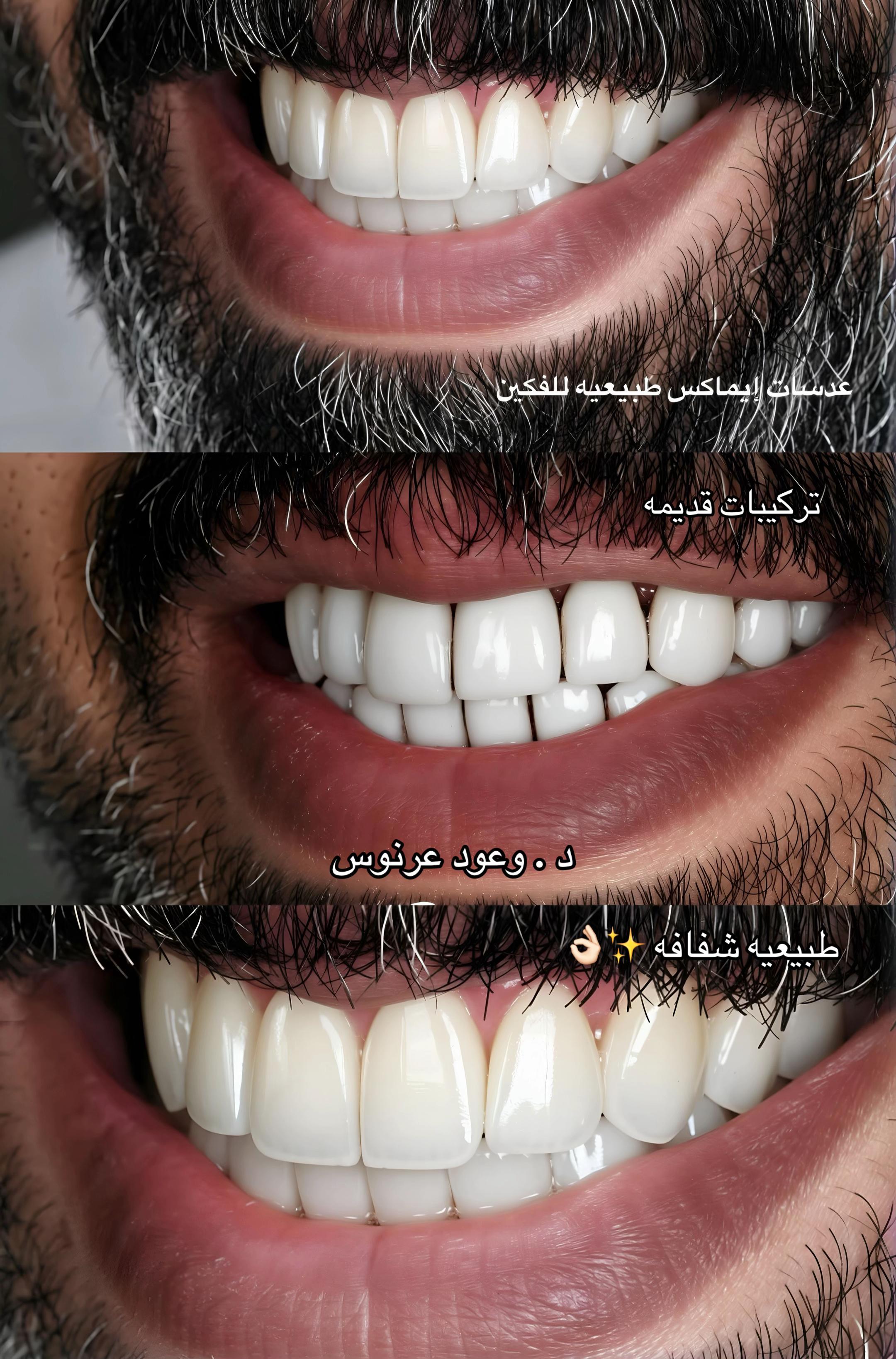 @مركز مزدانه 1 ( فرع الصحافه )