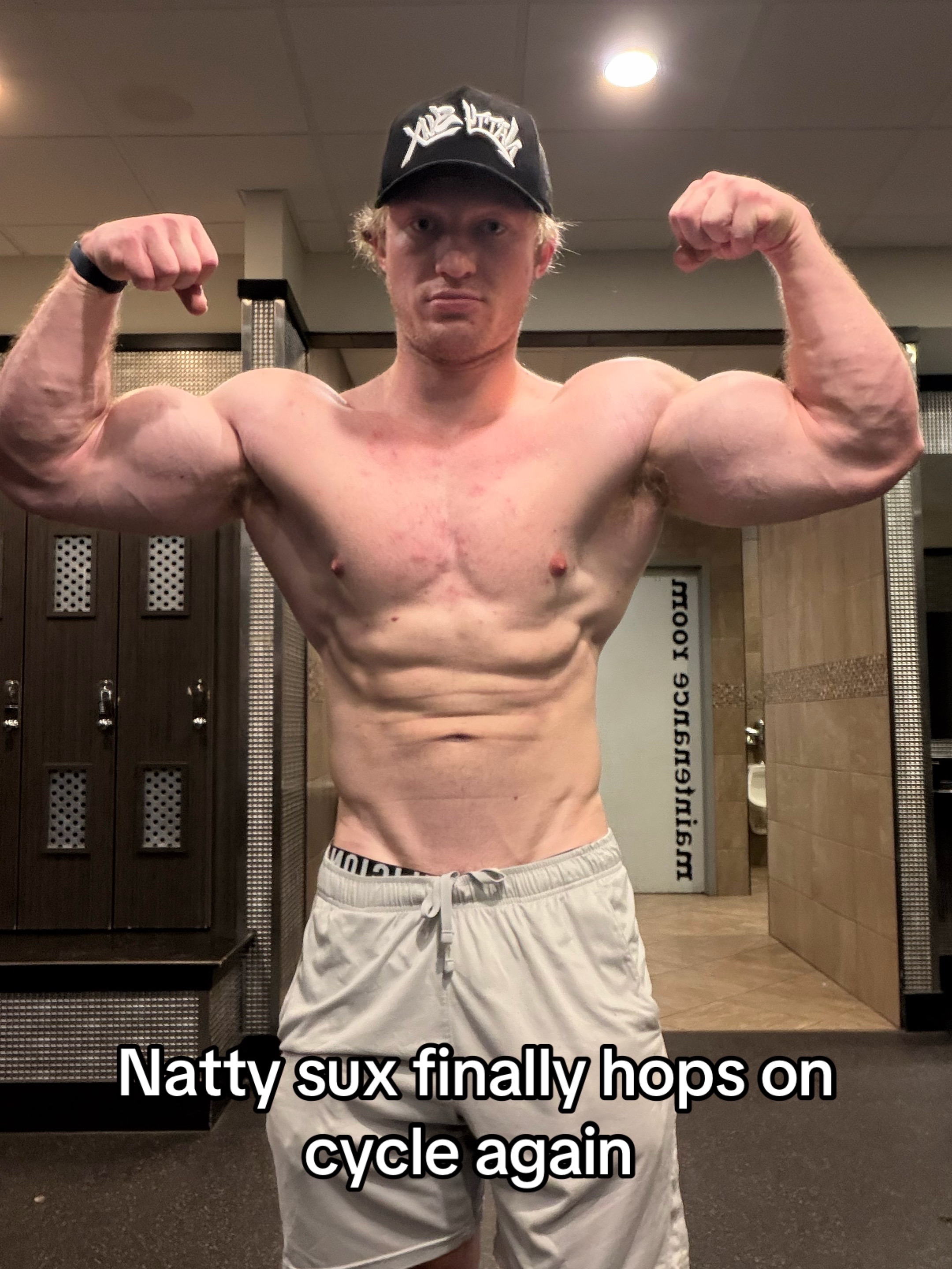 @NattySux