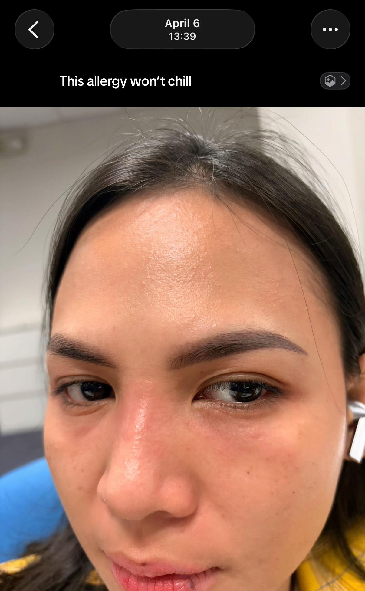 @Elay | The Skincare Junkie