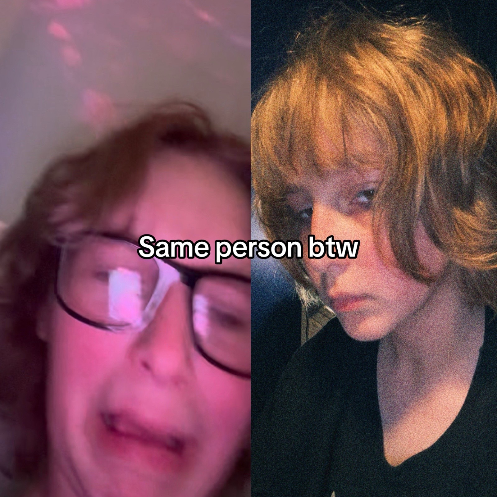 @XANO