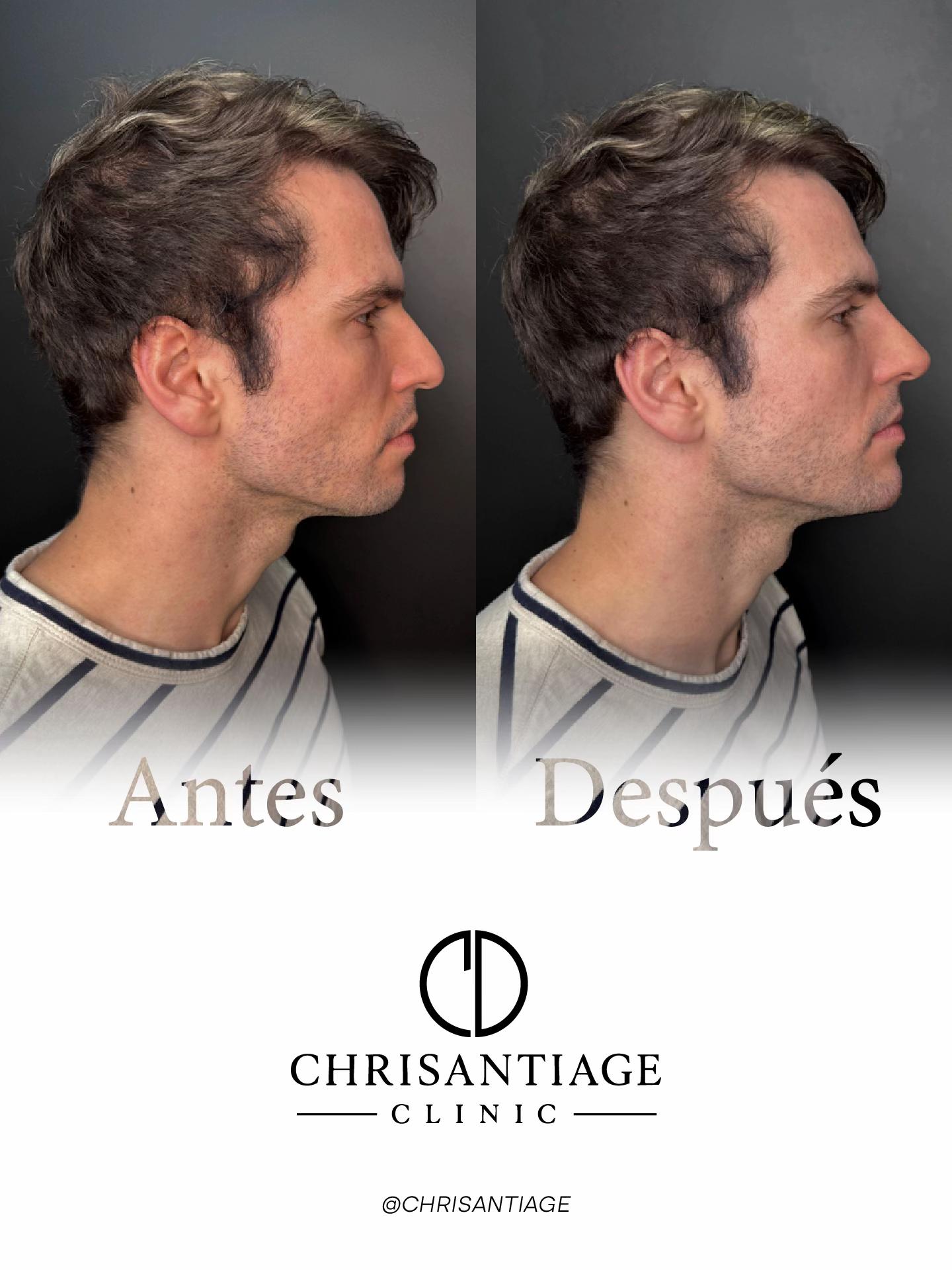 @chrisantiage