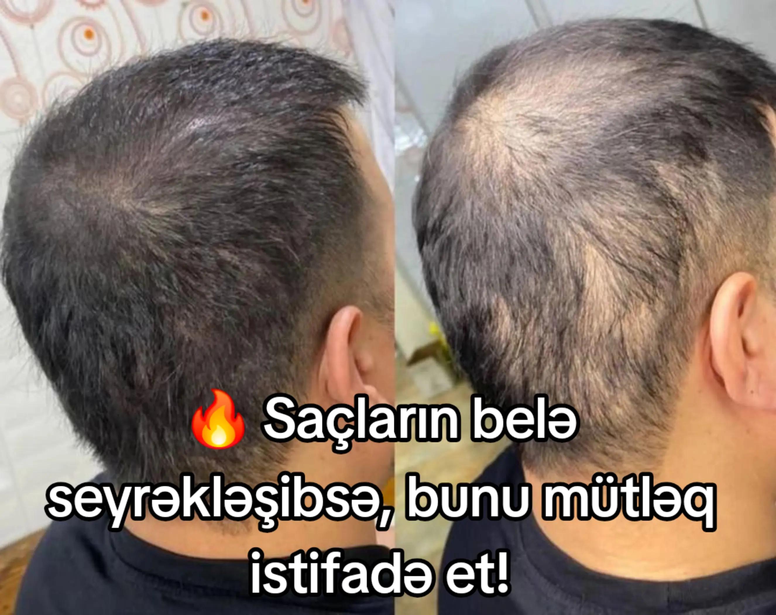 @BİOLA