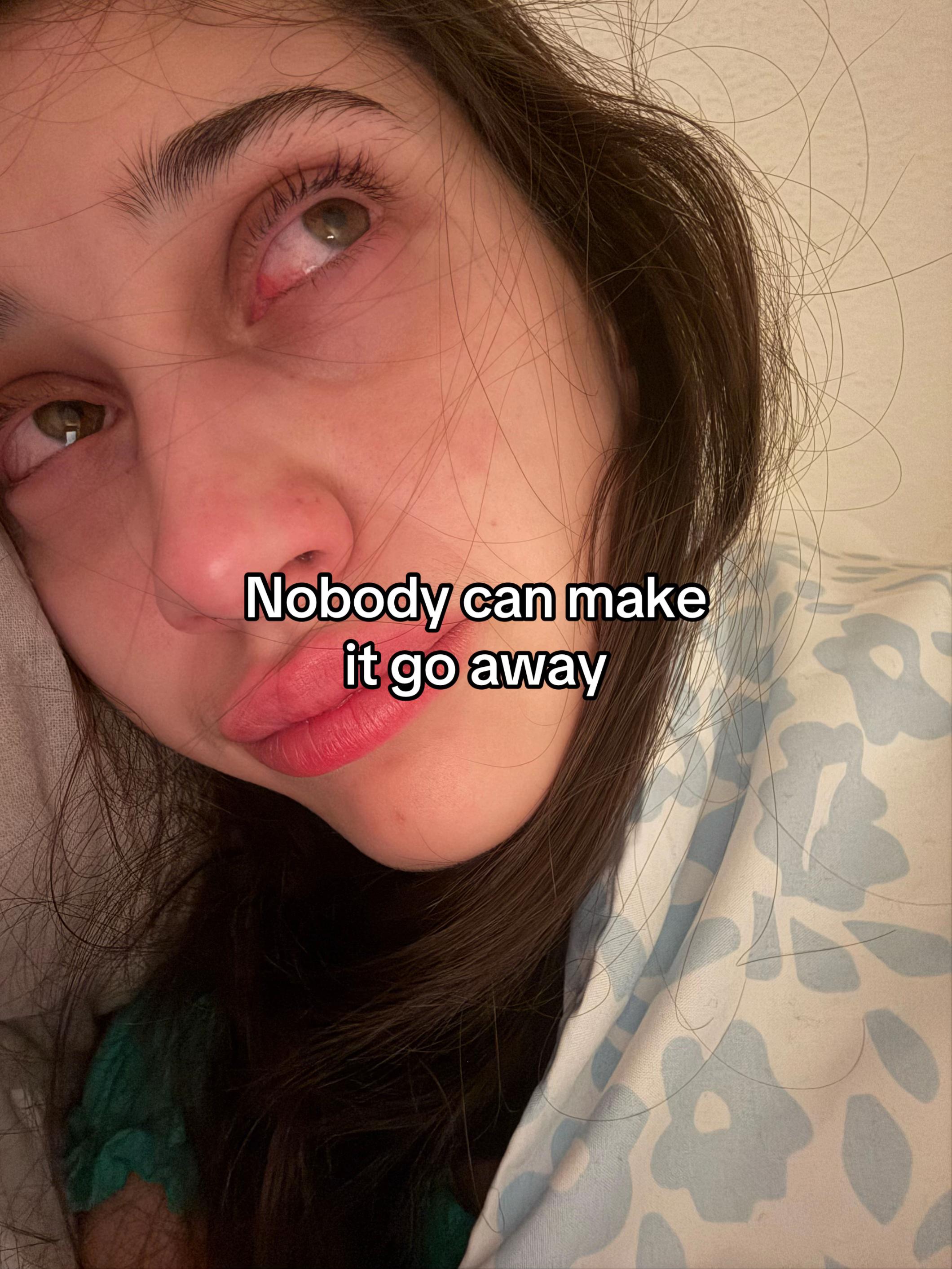 @S1RENA