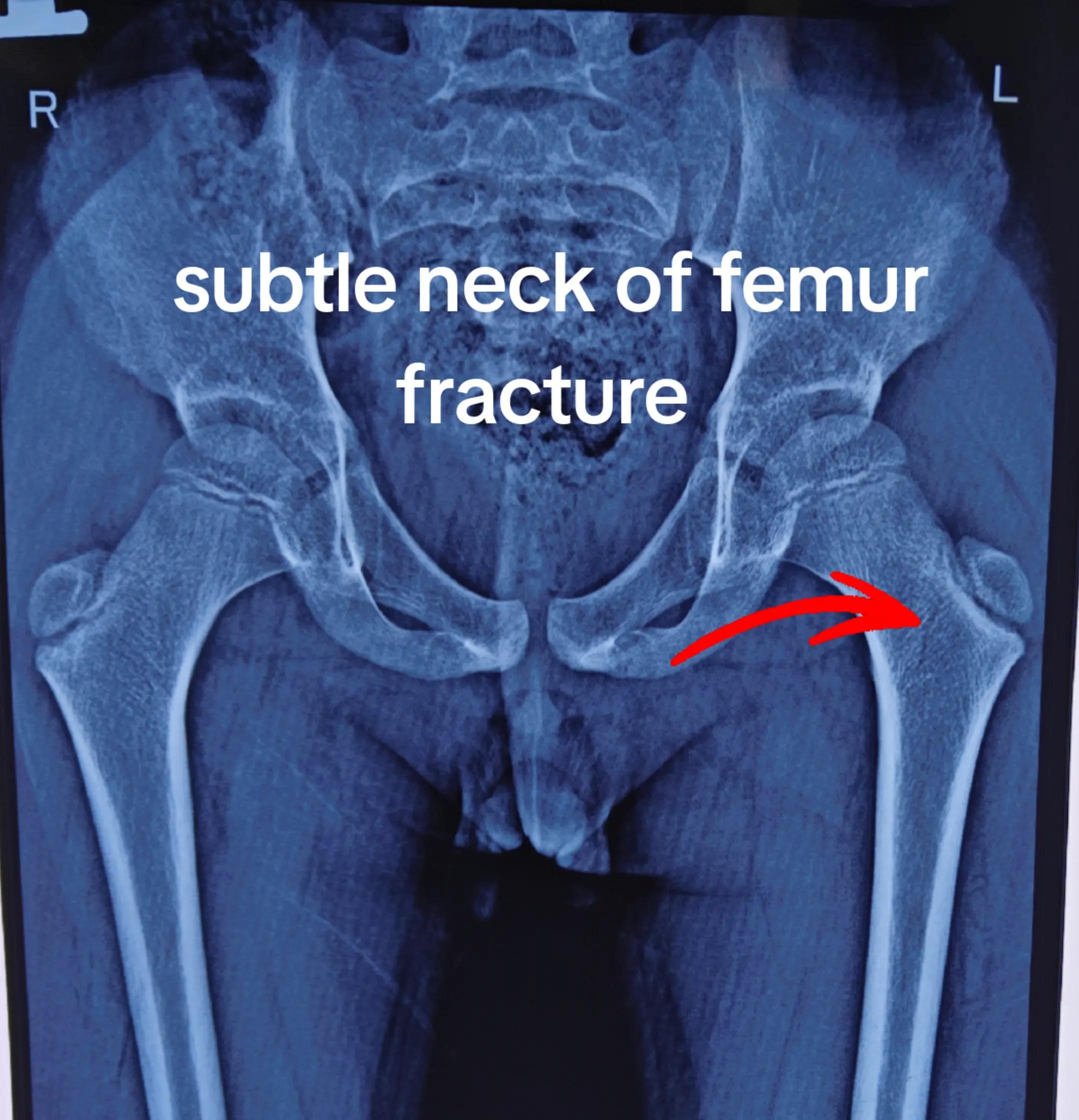 @Orthopedic_Surgeon_Arbind
