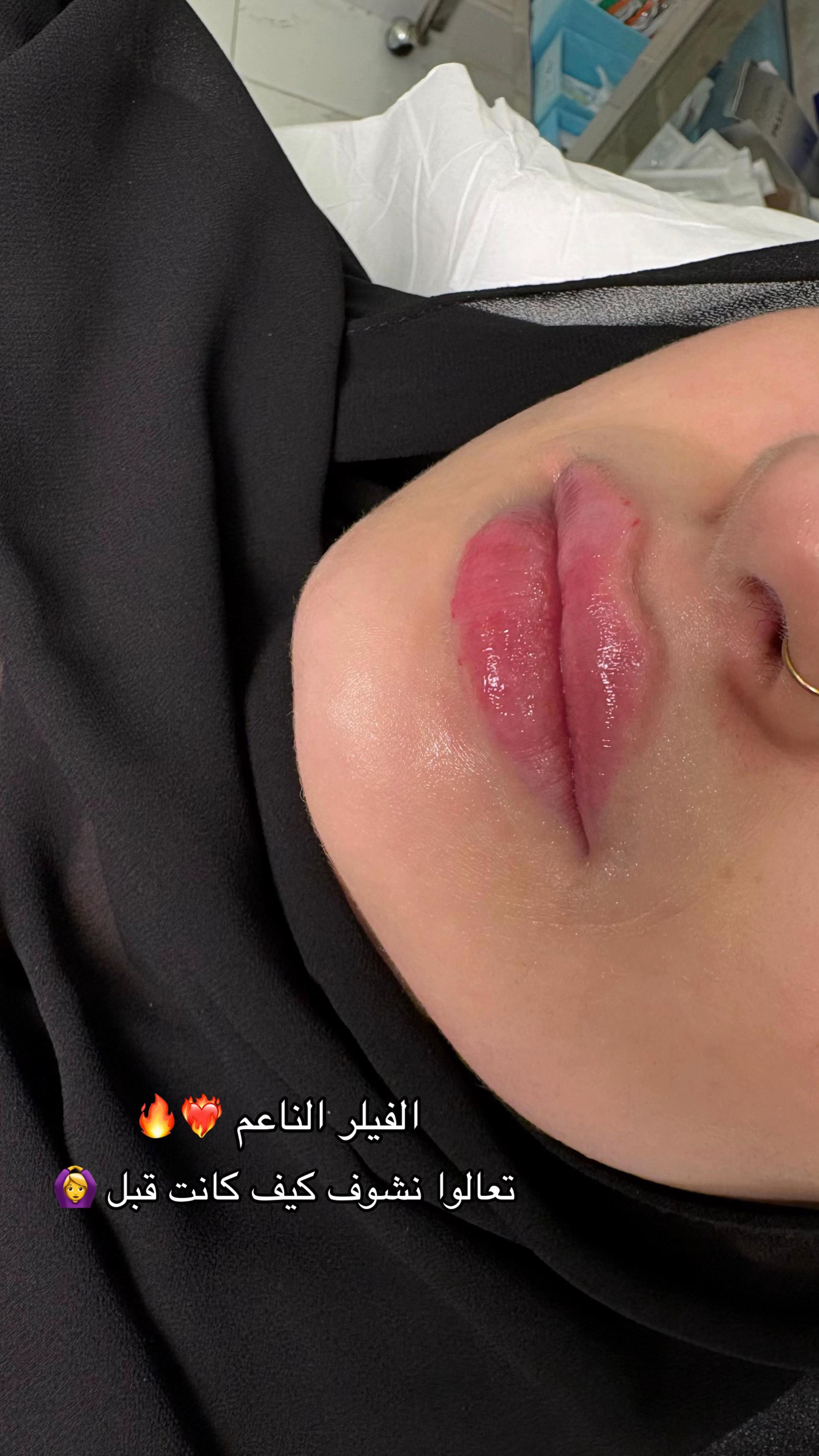 @مزدانه (فرع الملك عبدالله)