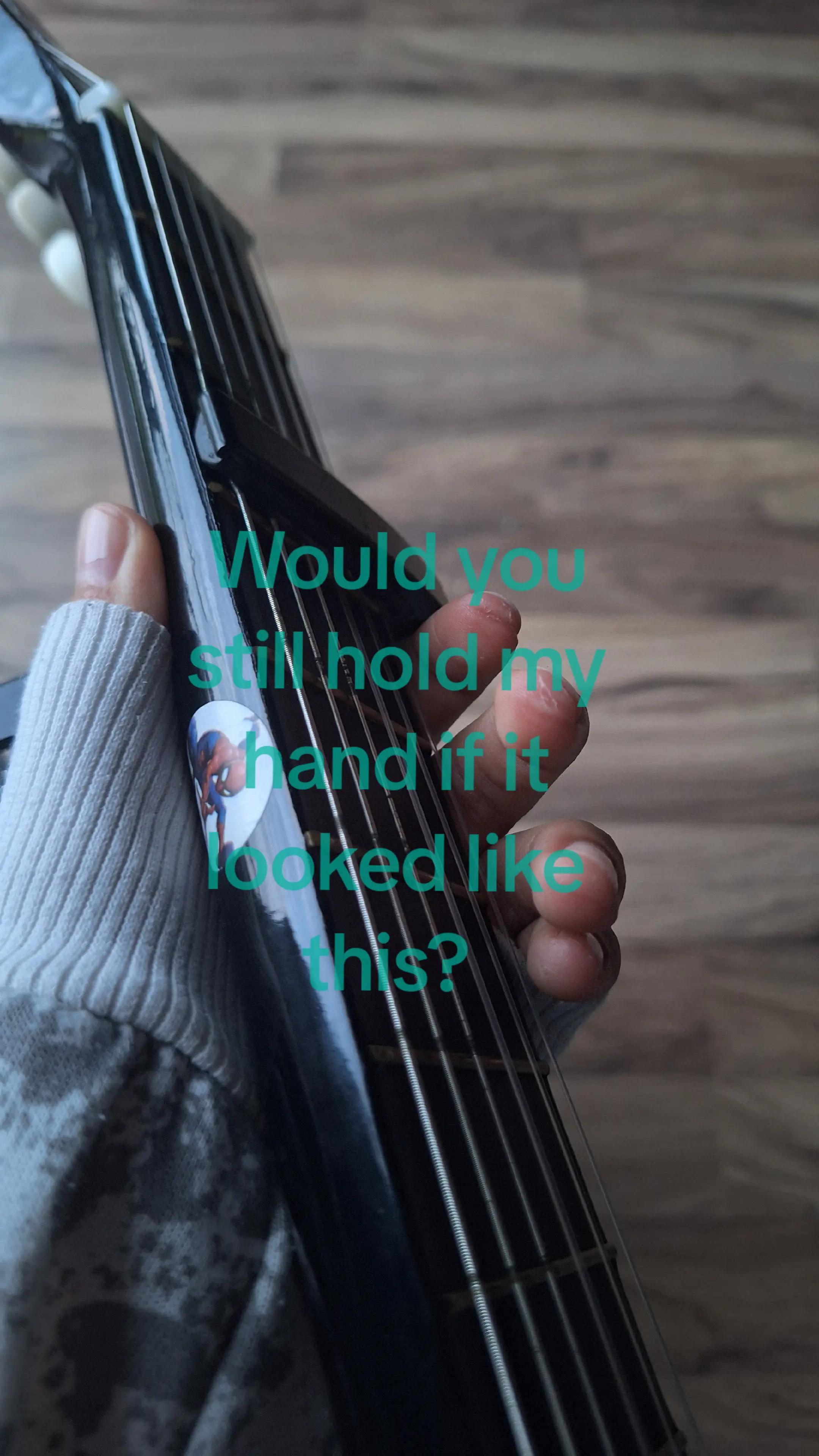 @vxyn