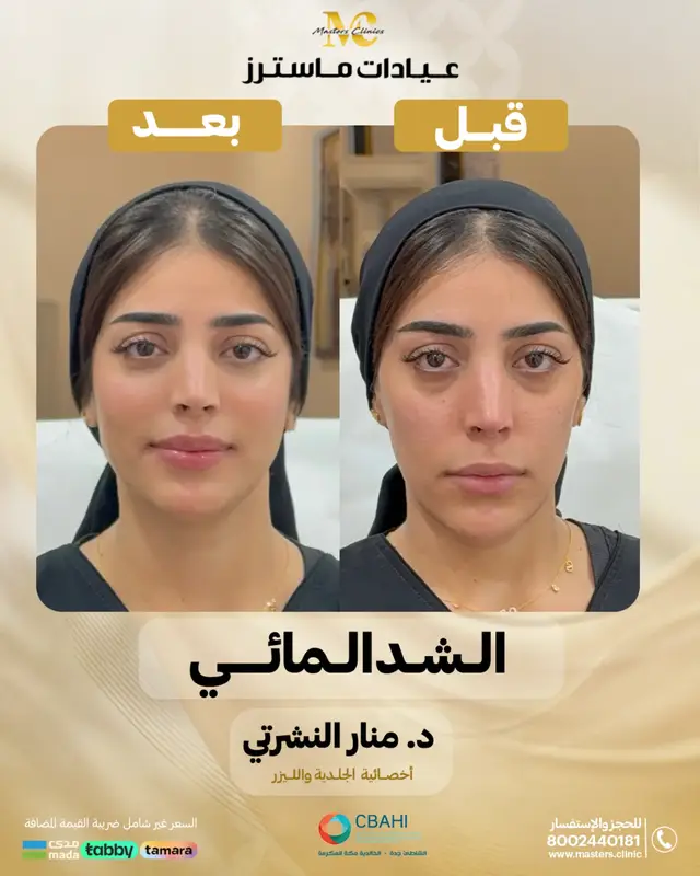 @عيادات ماسترز