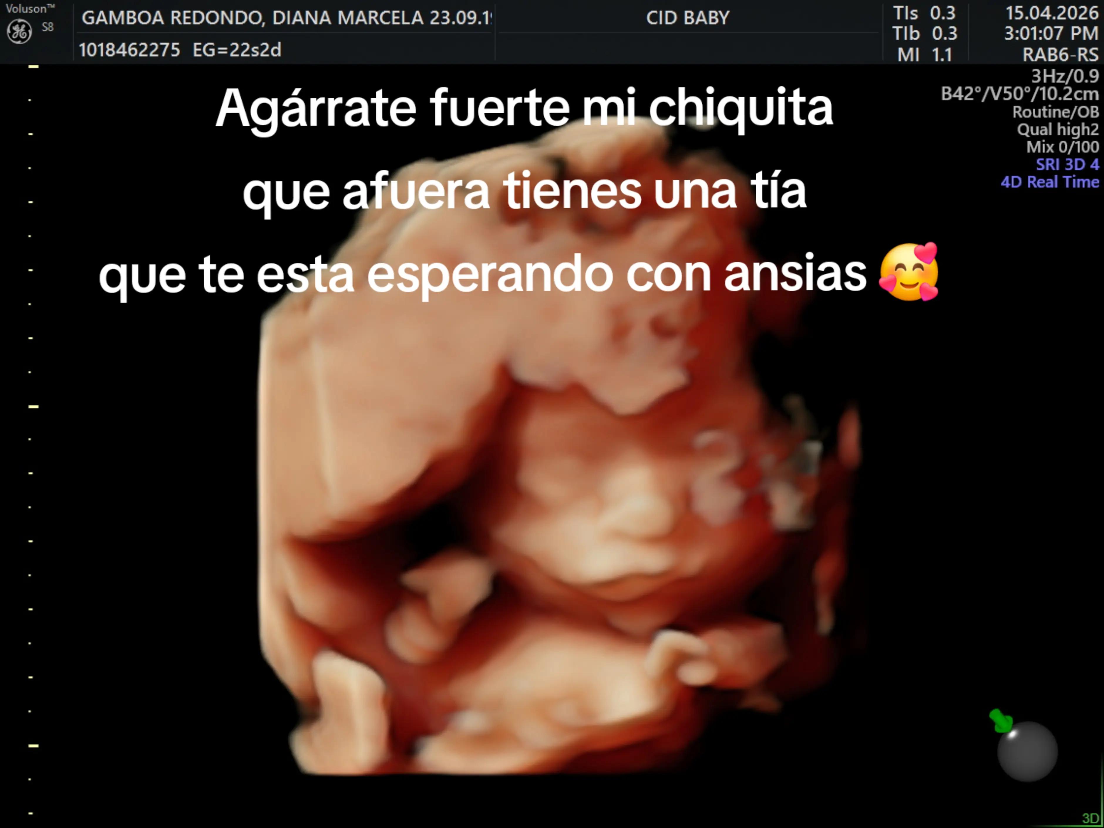 @Andrea Gamboa