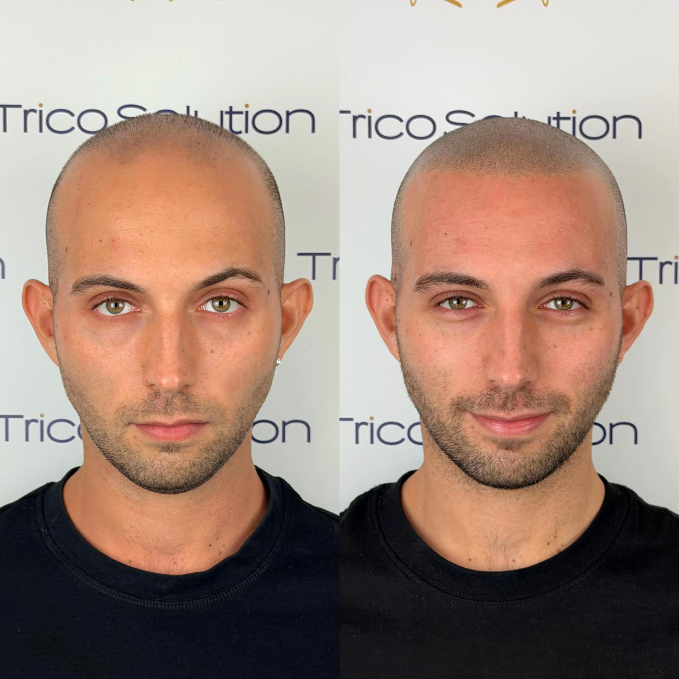 @TricoSolution di Davide Tini