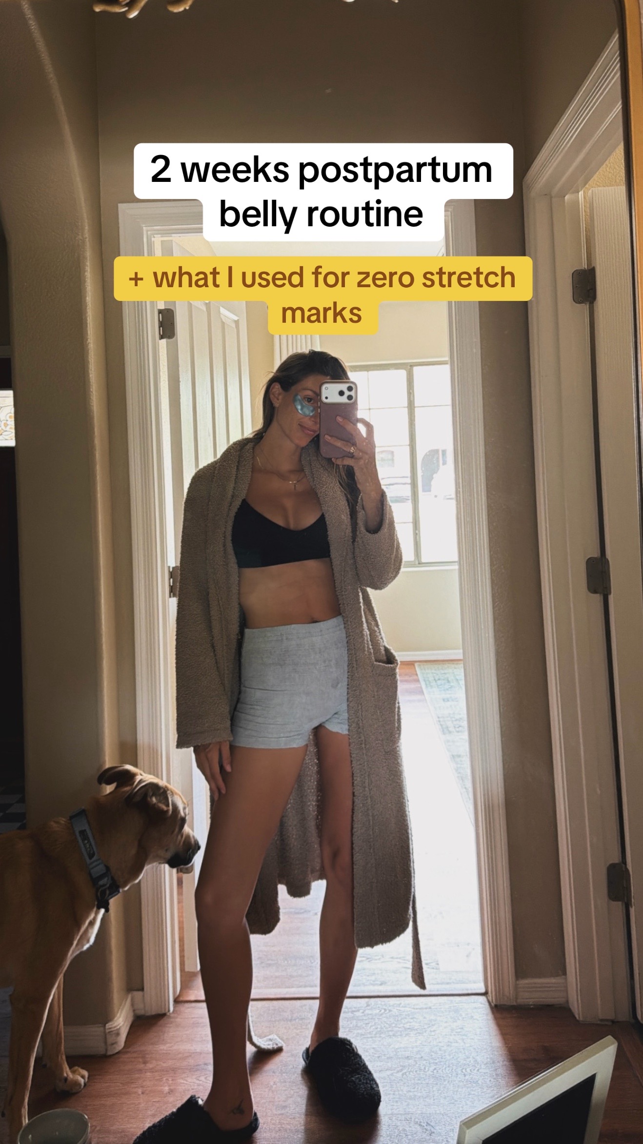 @Kaycee Ziefle