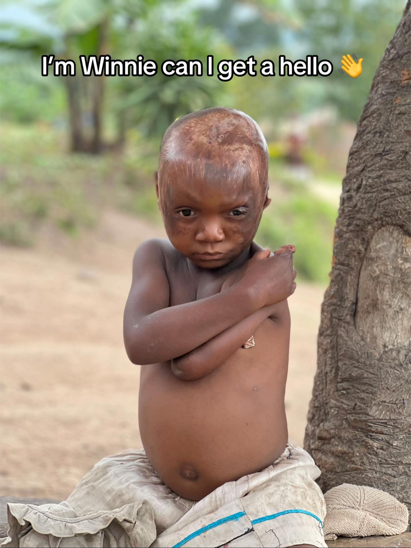 @markfoundation0