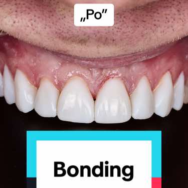 @Anna 🦷 dentystka