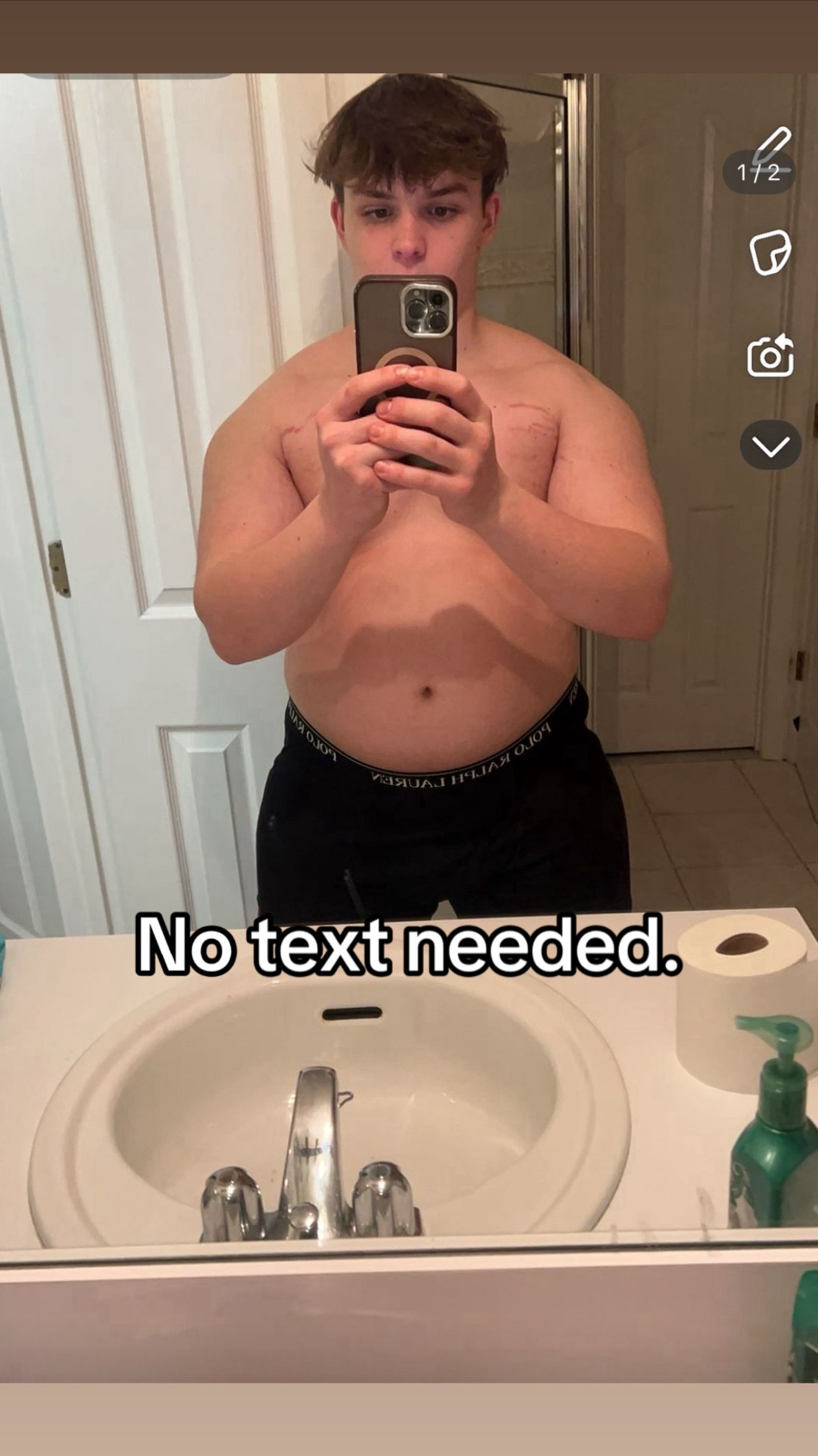 @SP