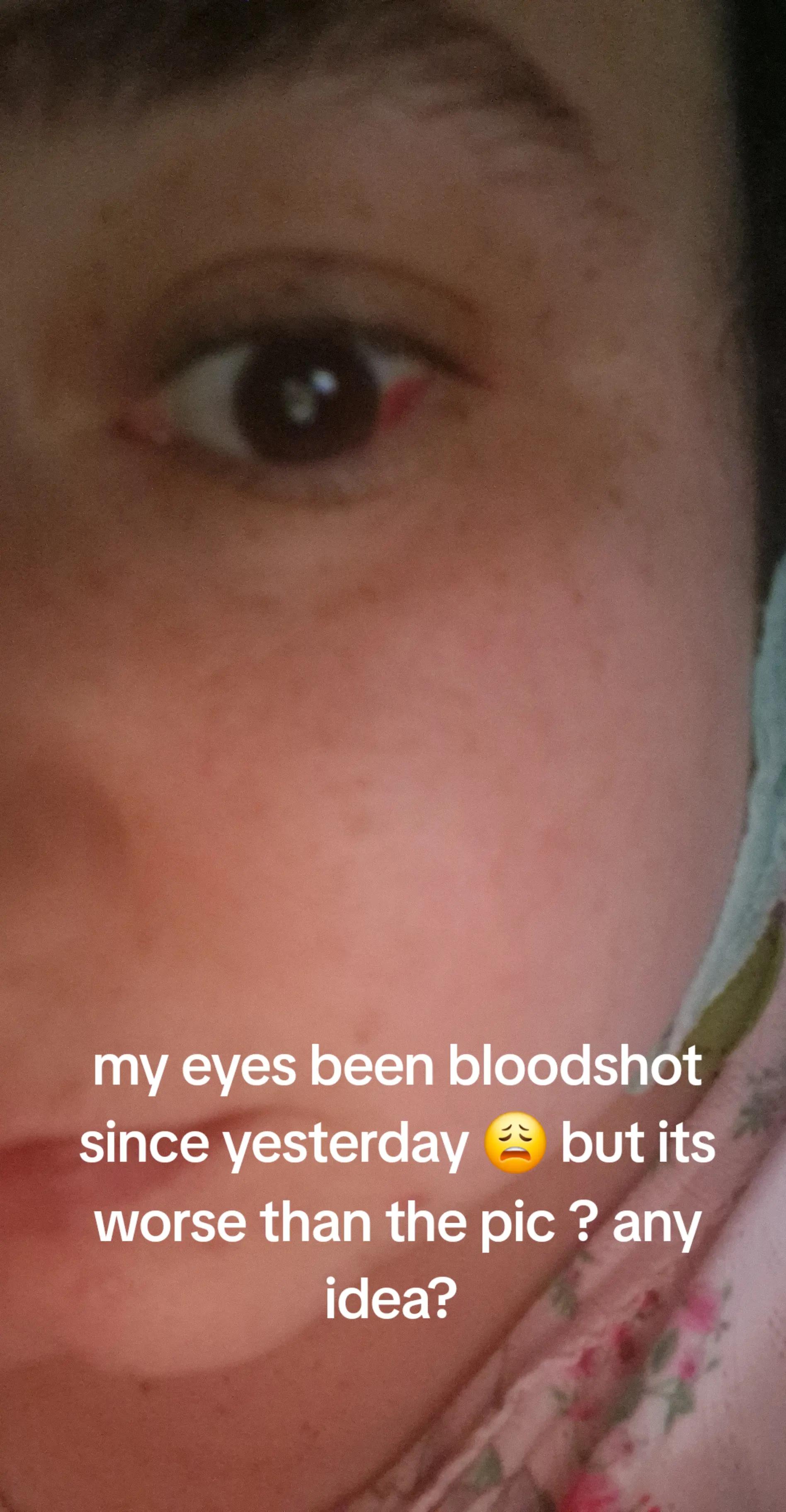 @simoneedianedizzle