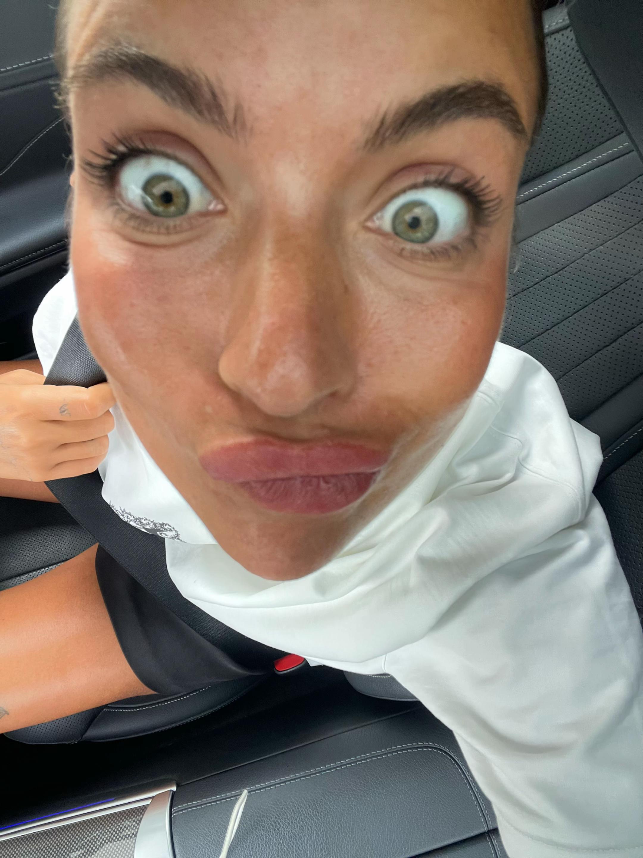 @Anazvkic