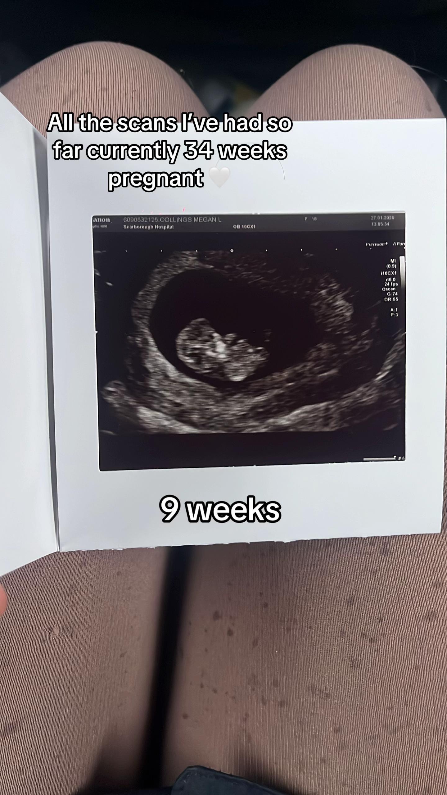@meg.teenmum