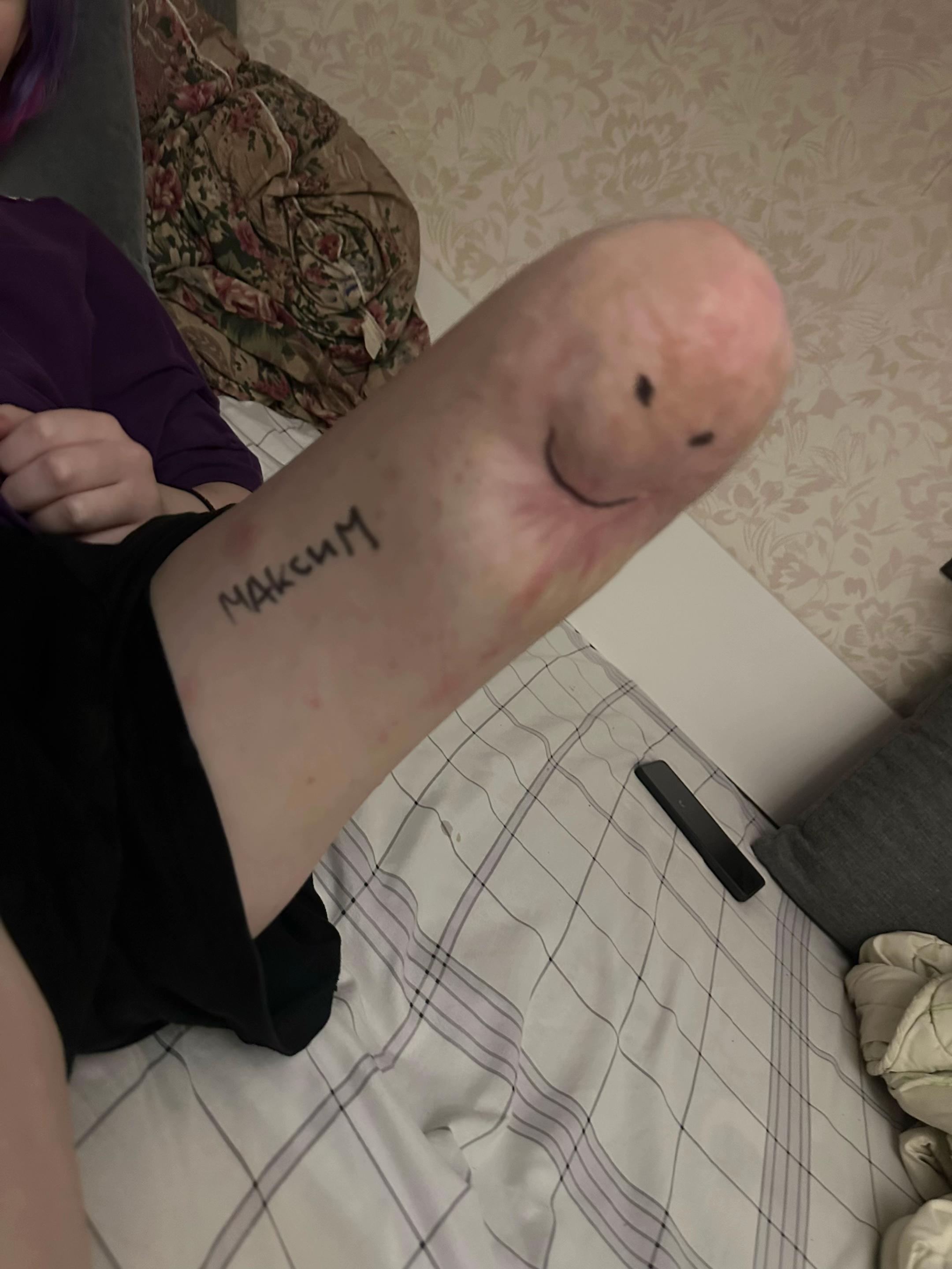 @бляднес