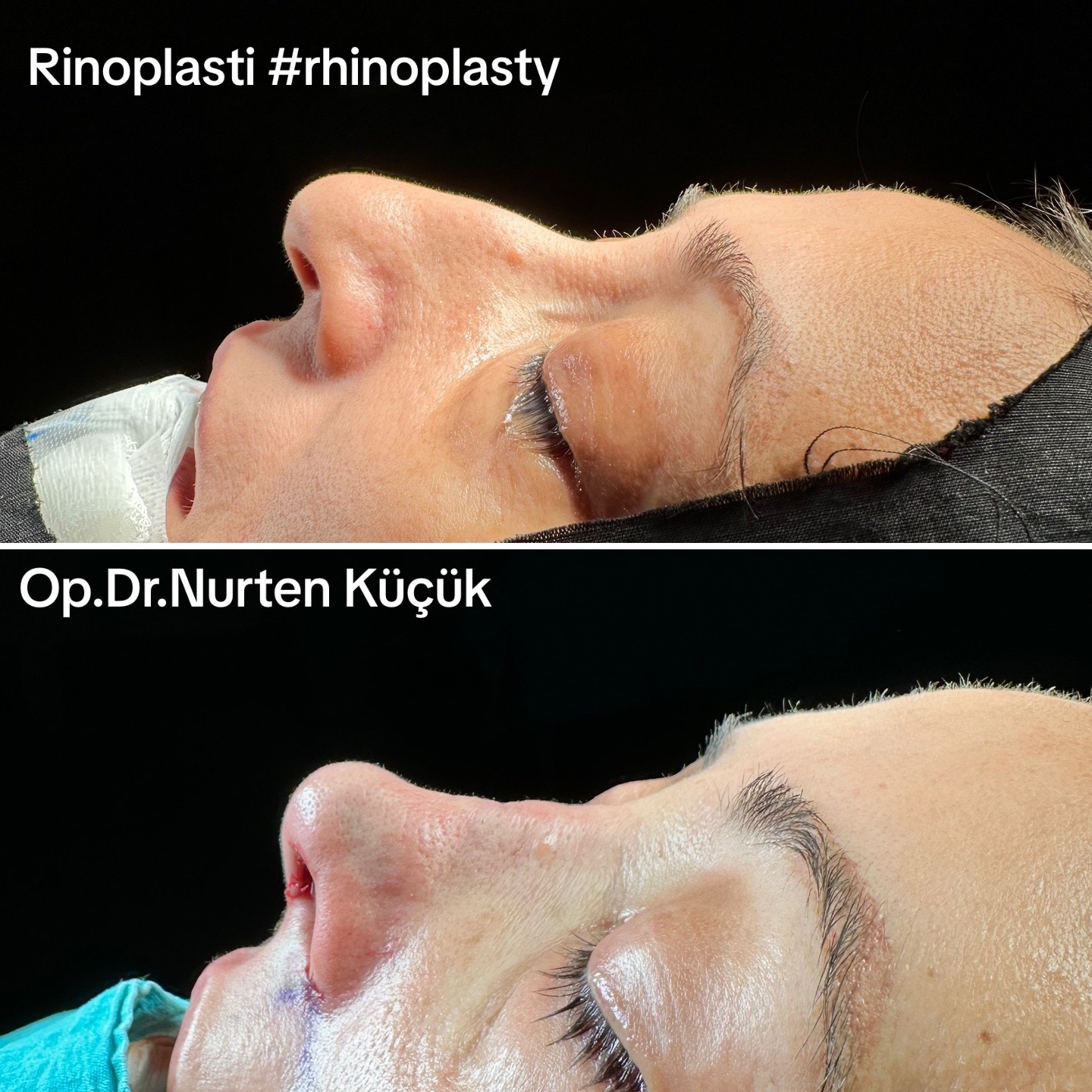 @Dr. NurtenKucuk