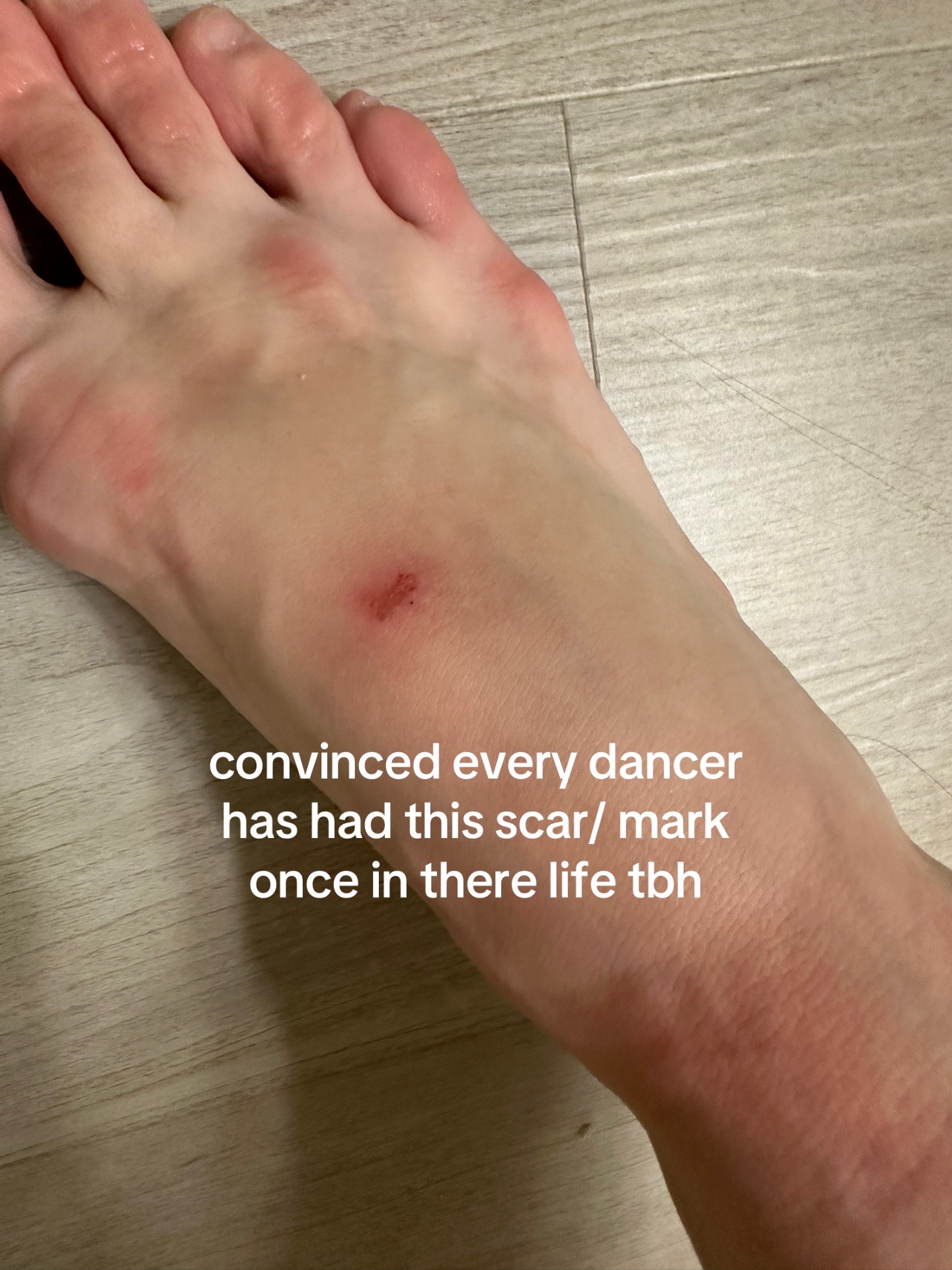@gianna corgiat