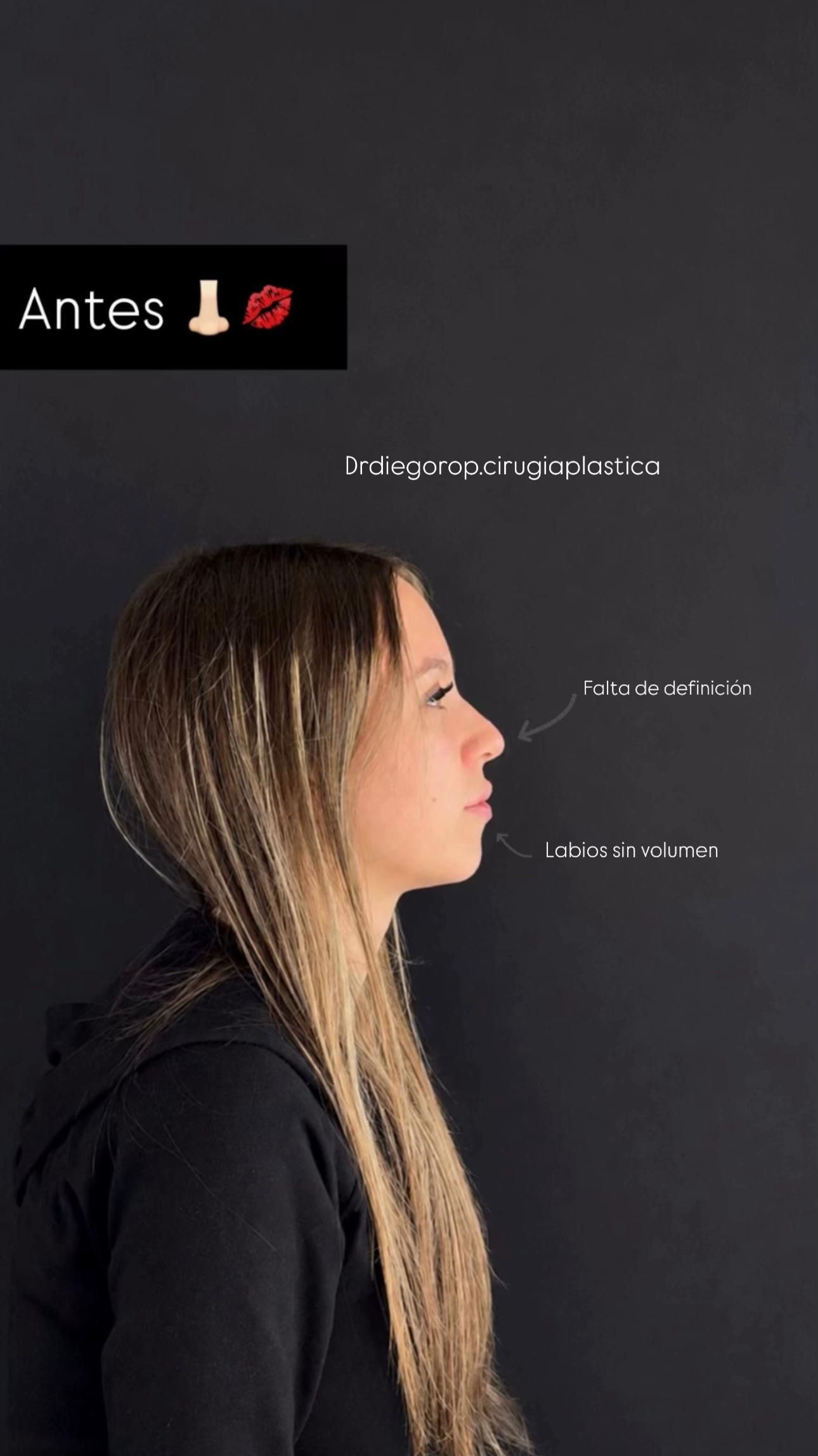 @Dr. Diego Rop
