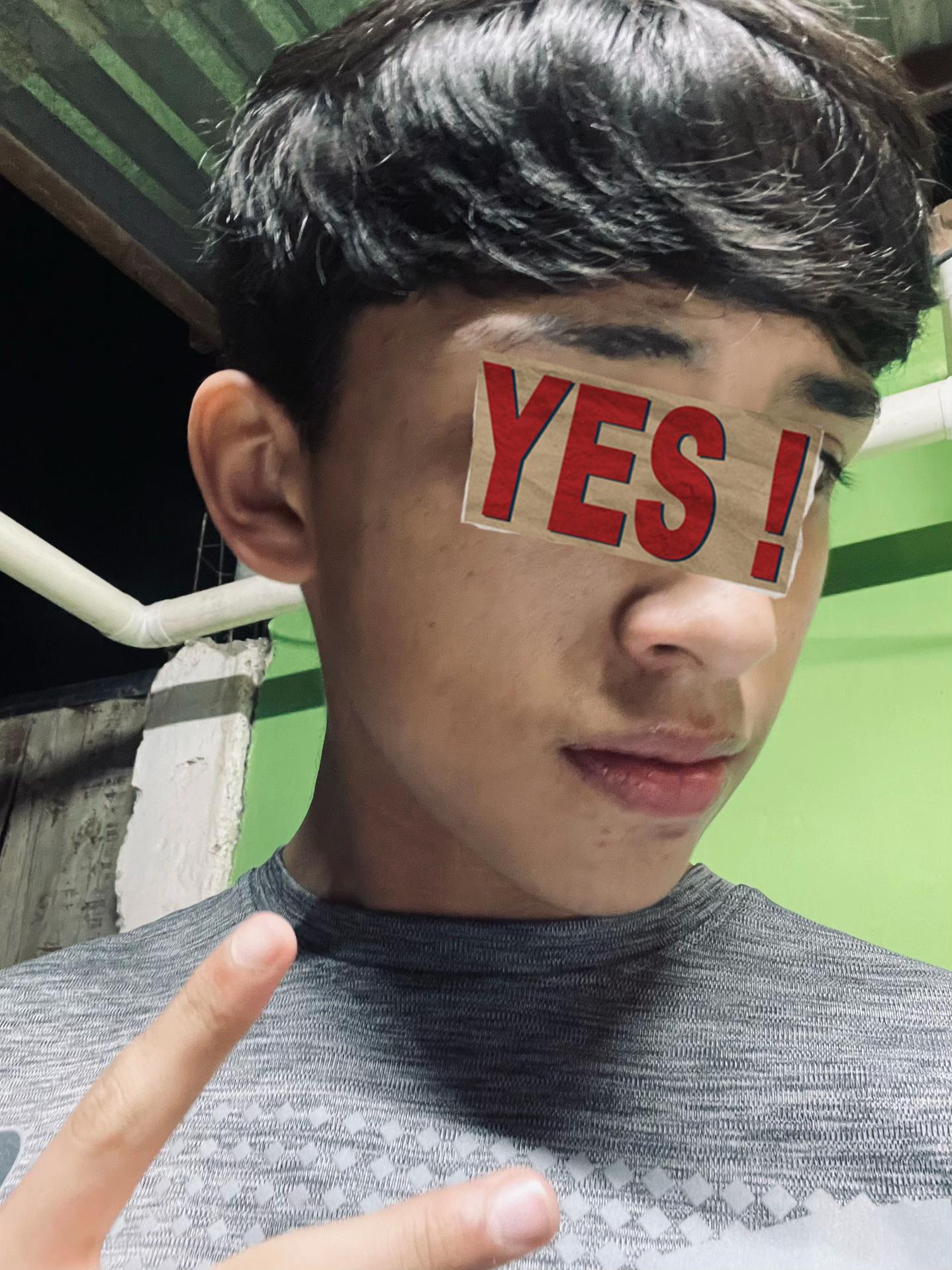 @Otz