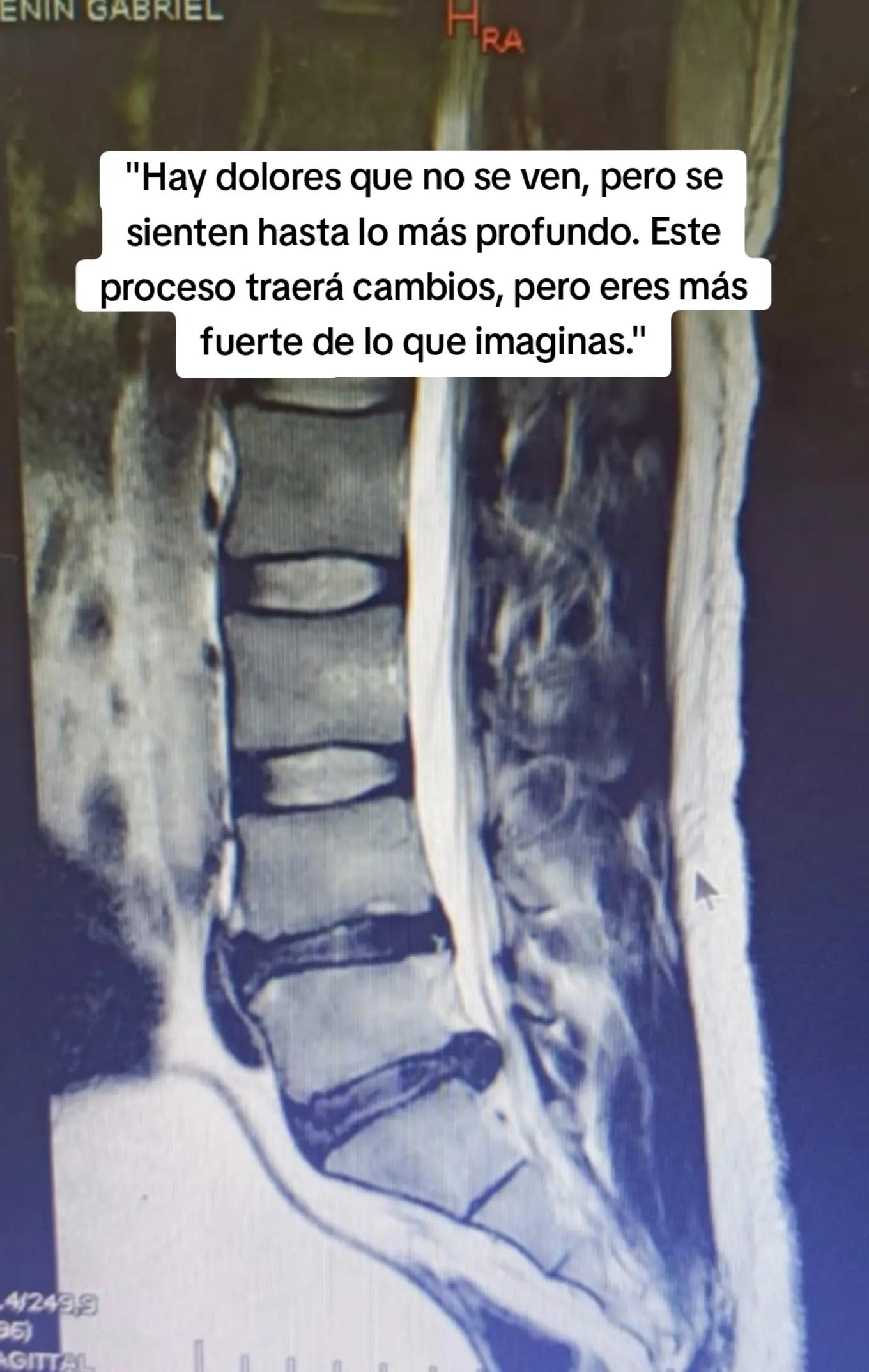 @Gabriel CM