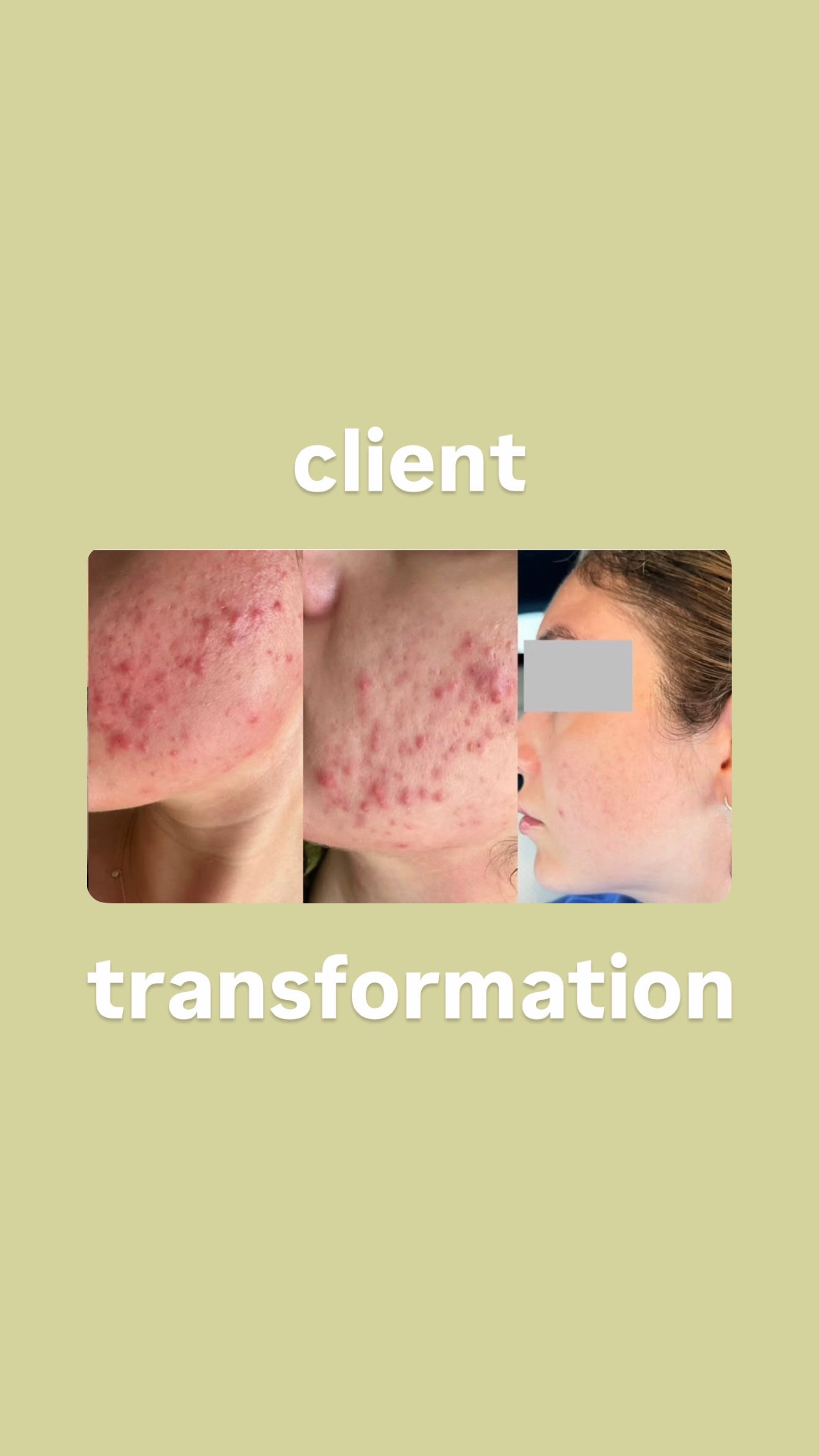 @Doctor Sheyda | Acne Expert