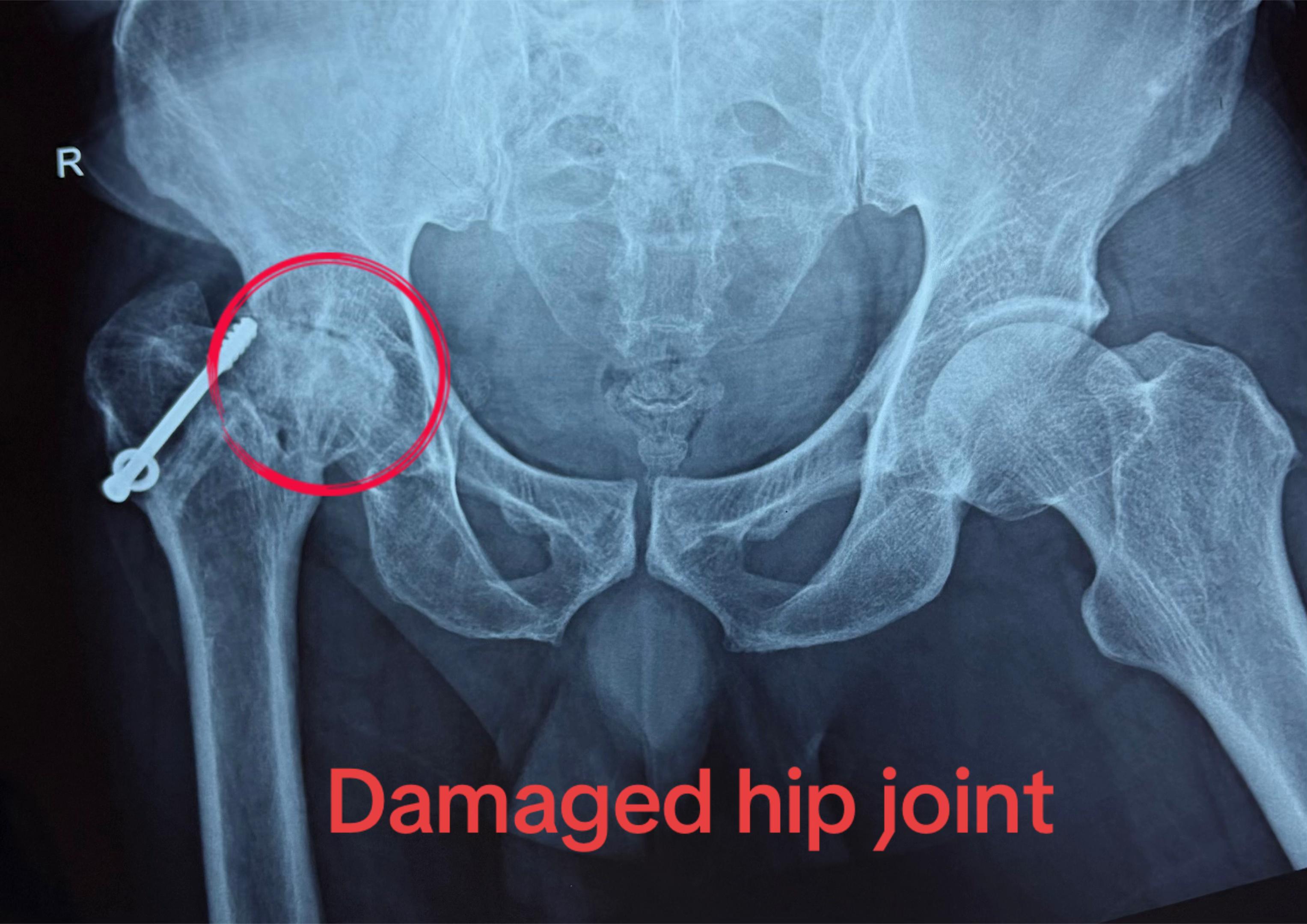 @Orthopedic_Surgeon_Arbind