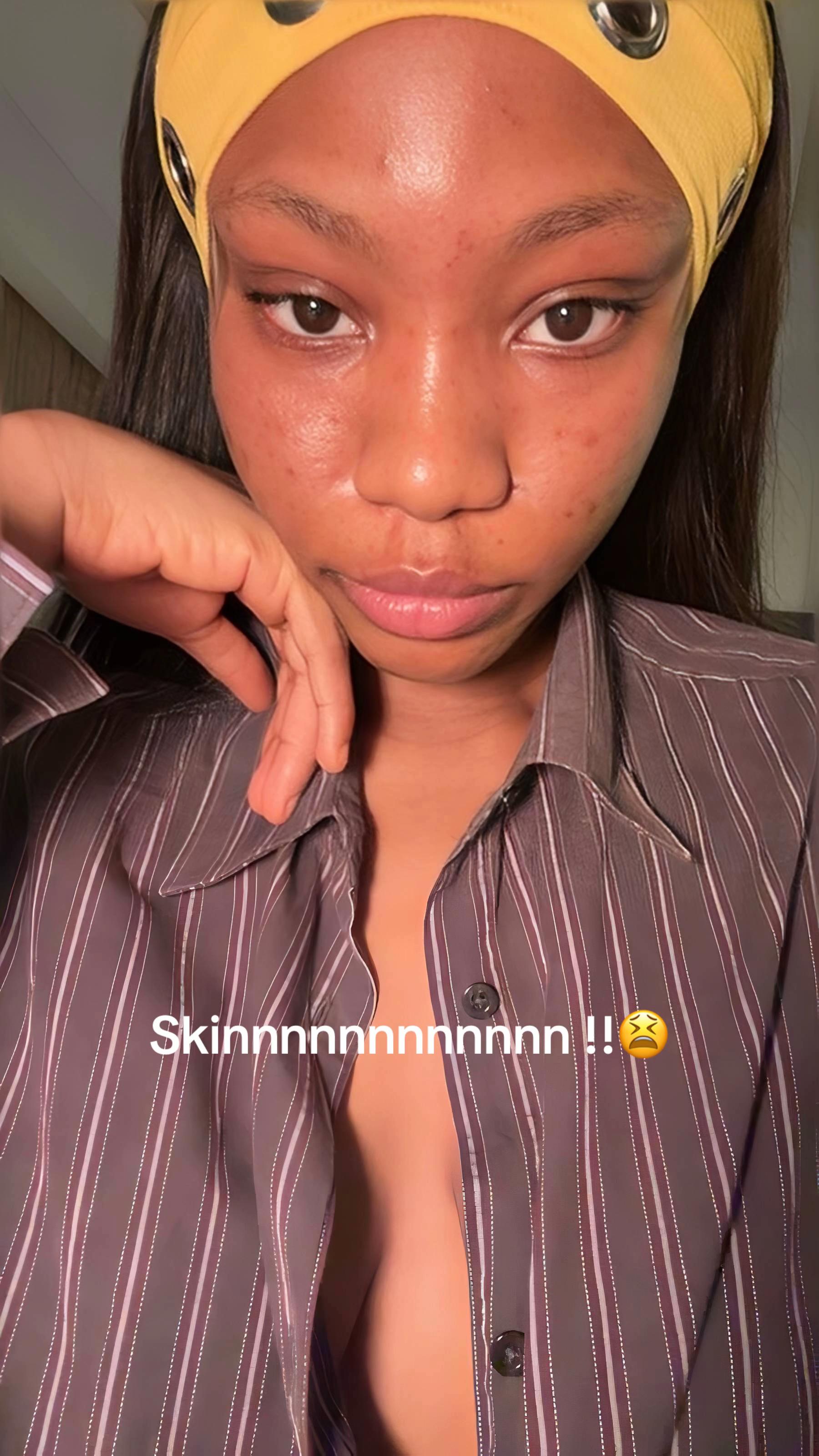 @.