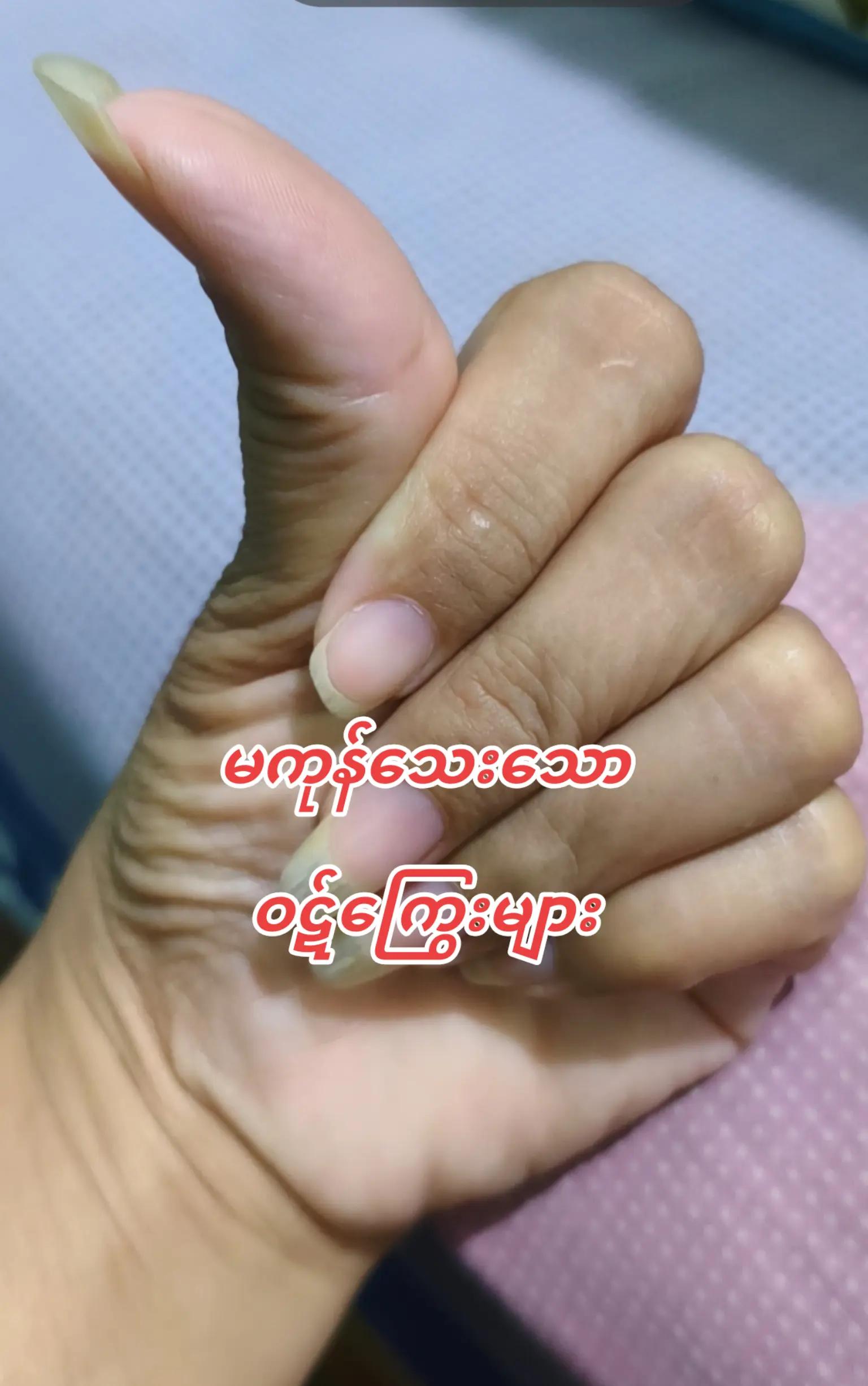 @Moe Thae Phyu(Mdy)
