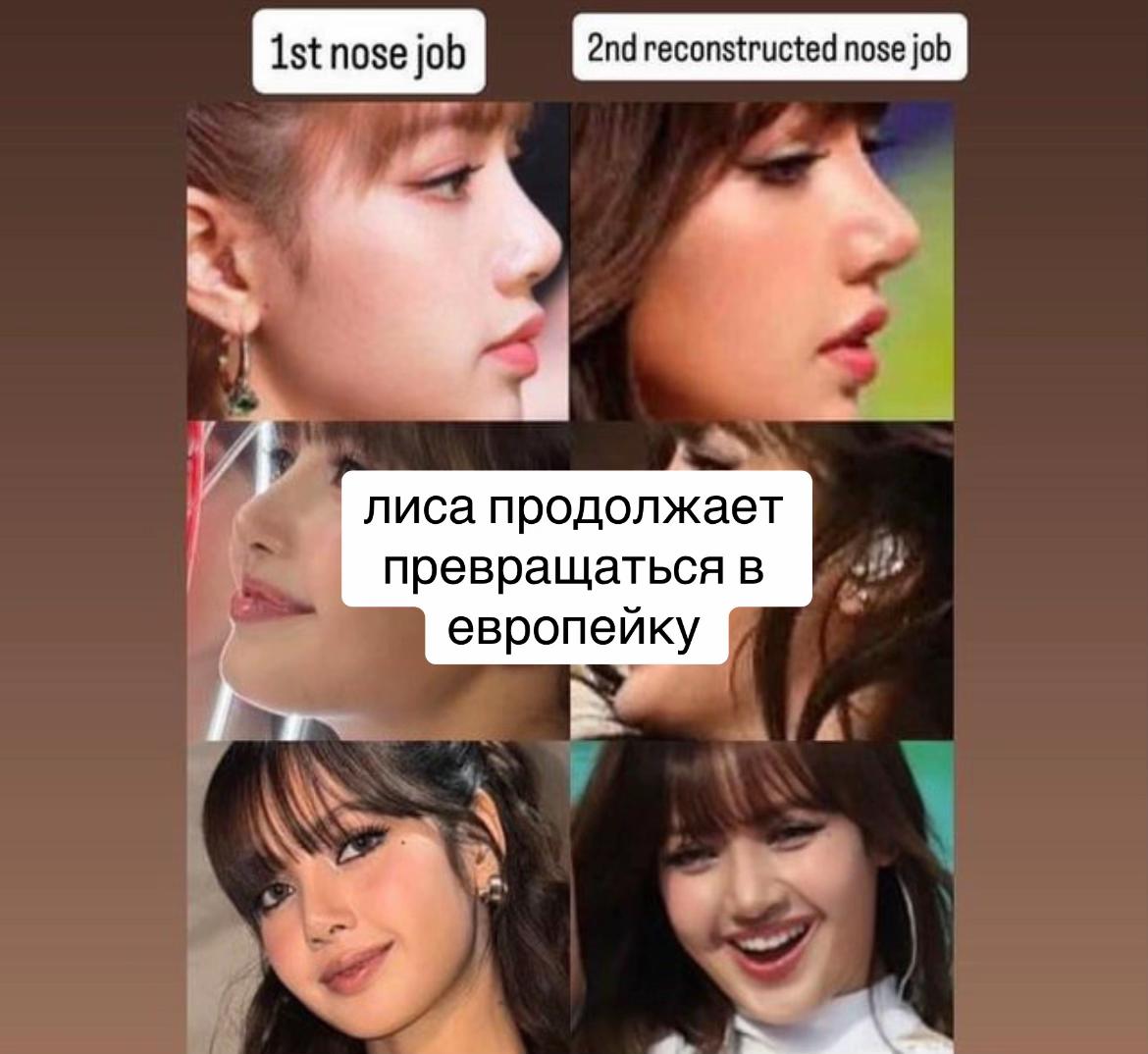 @openeyes