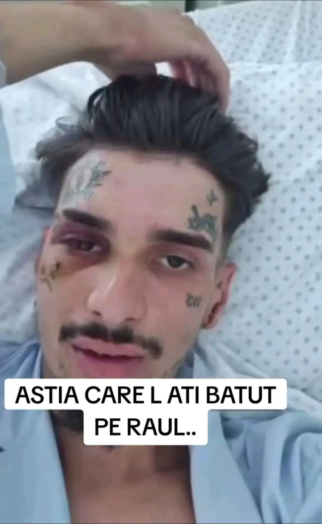 @Renato Lacrimă