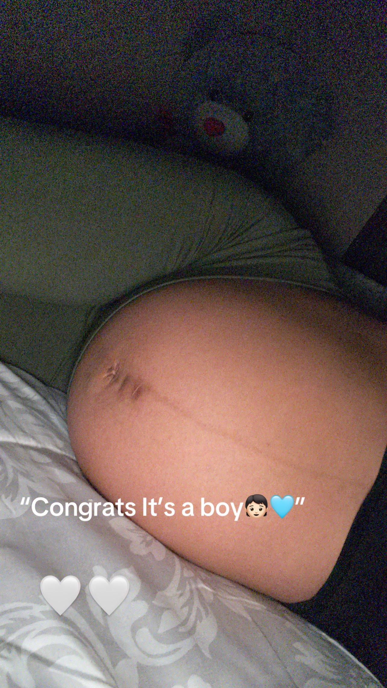 @Analexis💗