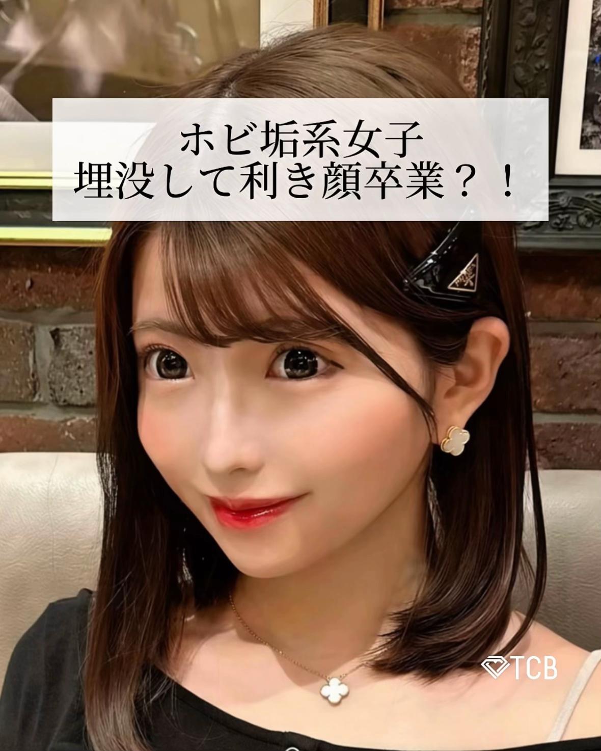 @【二重整形】TCB 新宿東口院ゆいこ先生/東京