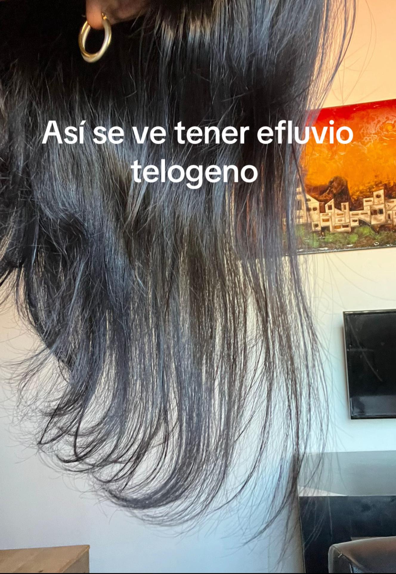 @Johafranciani