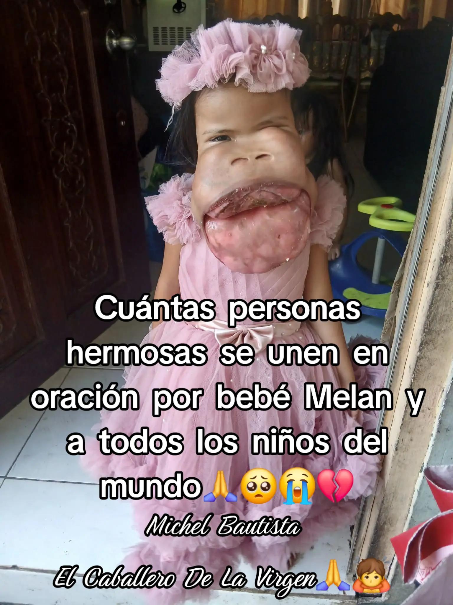 @Michel Bautista