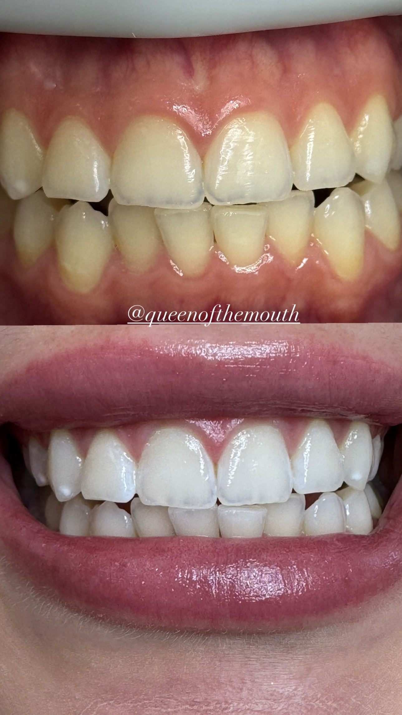 @Queenofthemouth