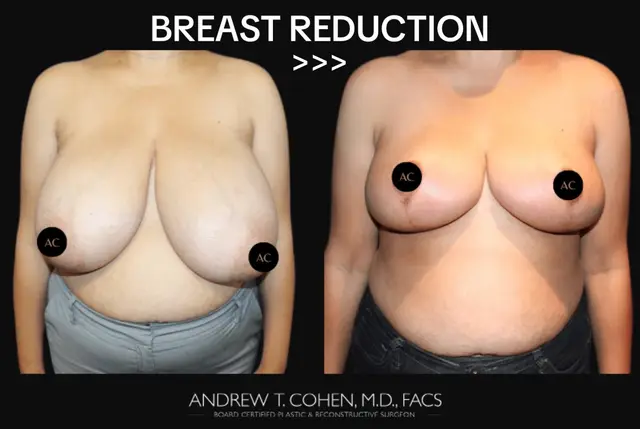 @Cohen MD Plastic Surgery