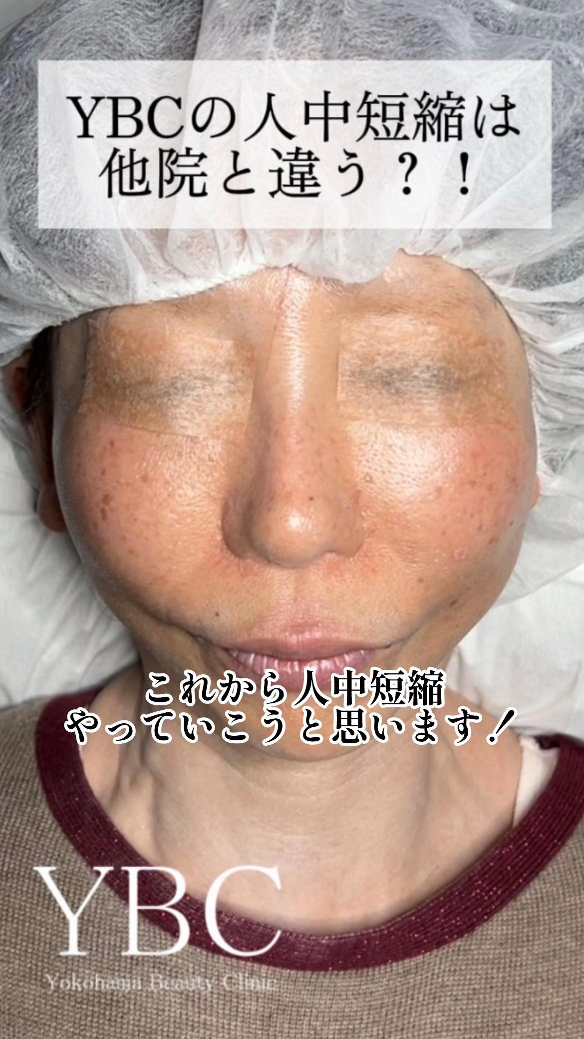 @イソセン/美容外科医（磯村亮輔院長）